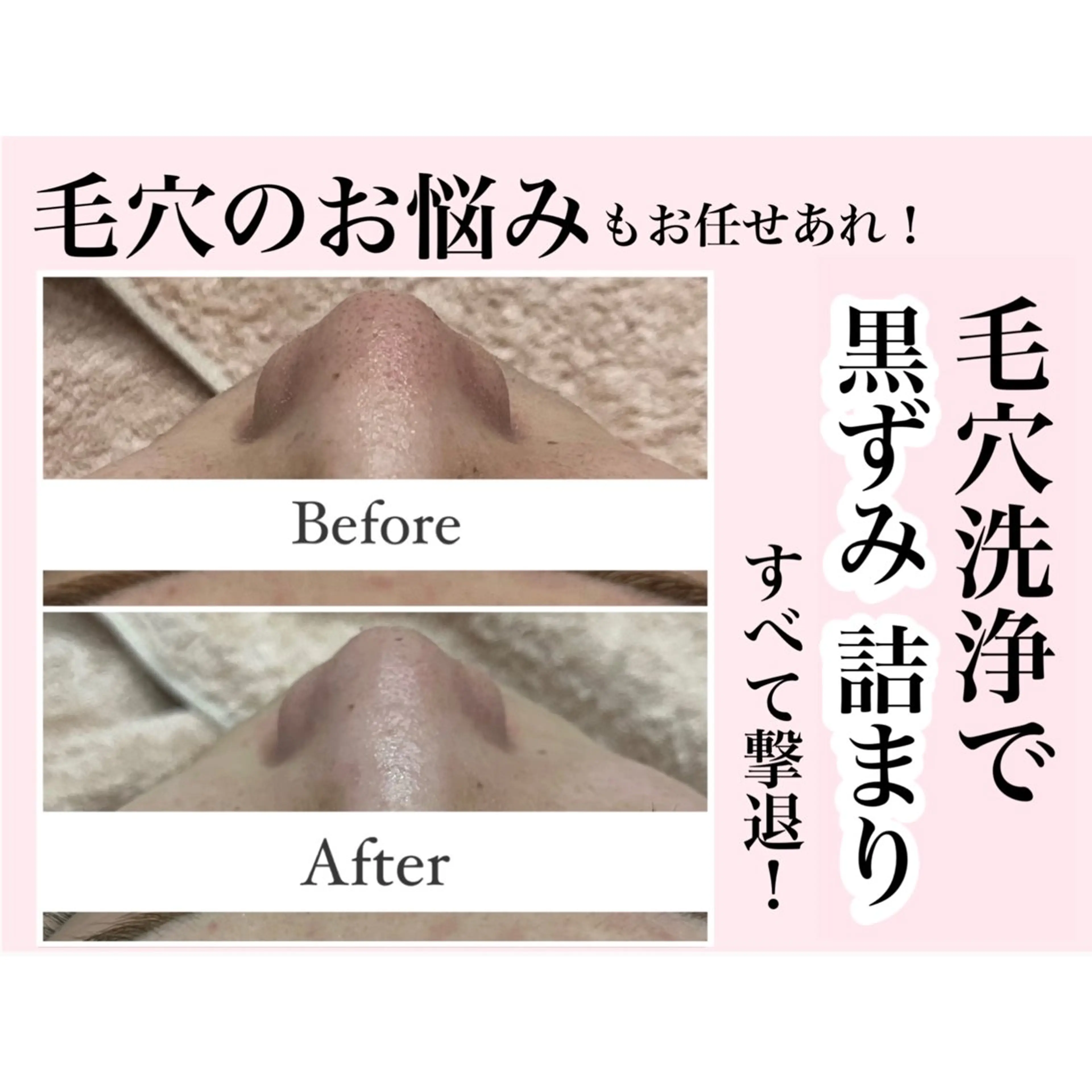 口コミ用🩷の写真