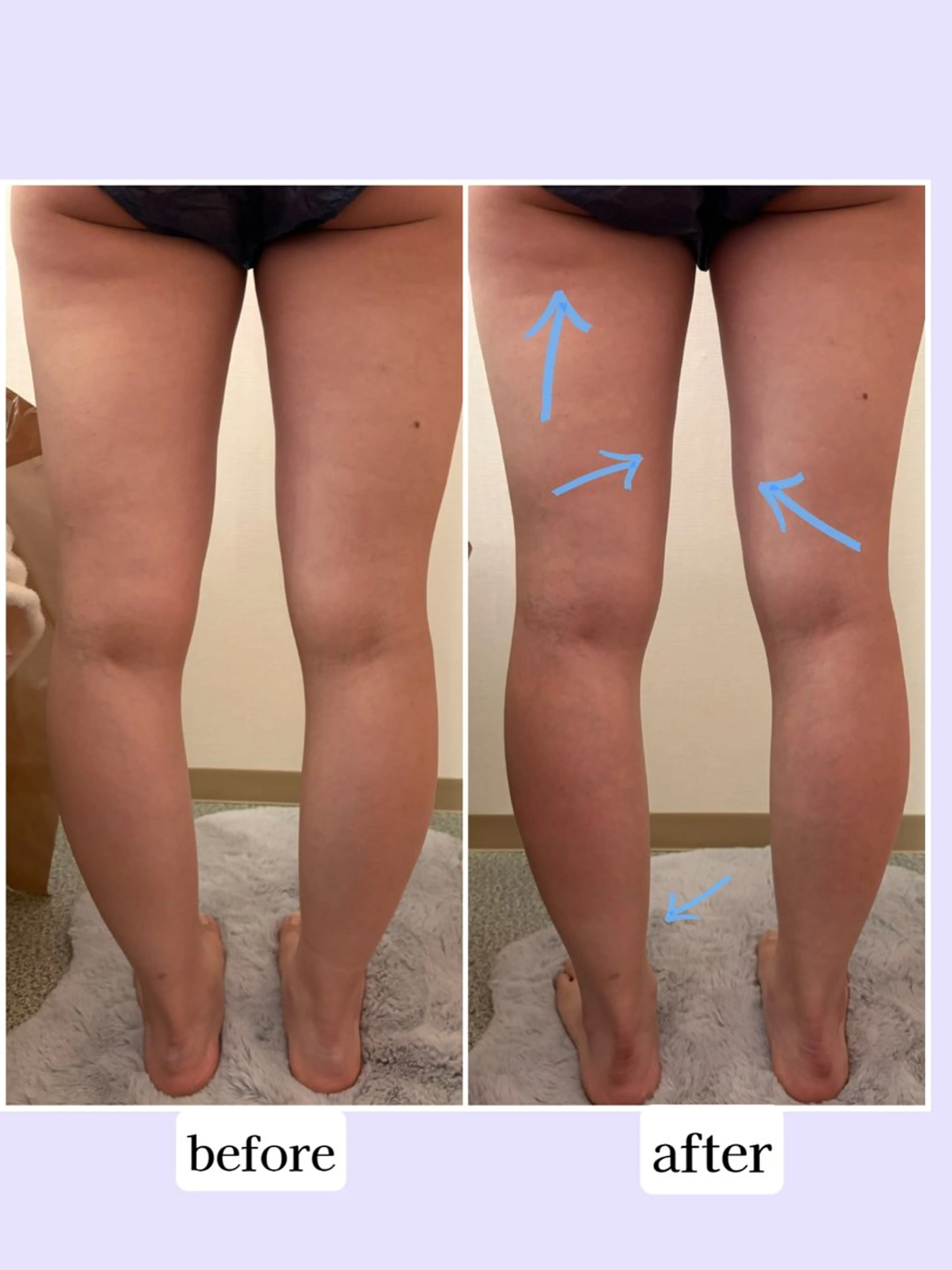 エステ Karen Private Spa所属・💜Karen PrivateSpaのエステ・リラクイメージ