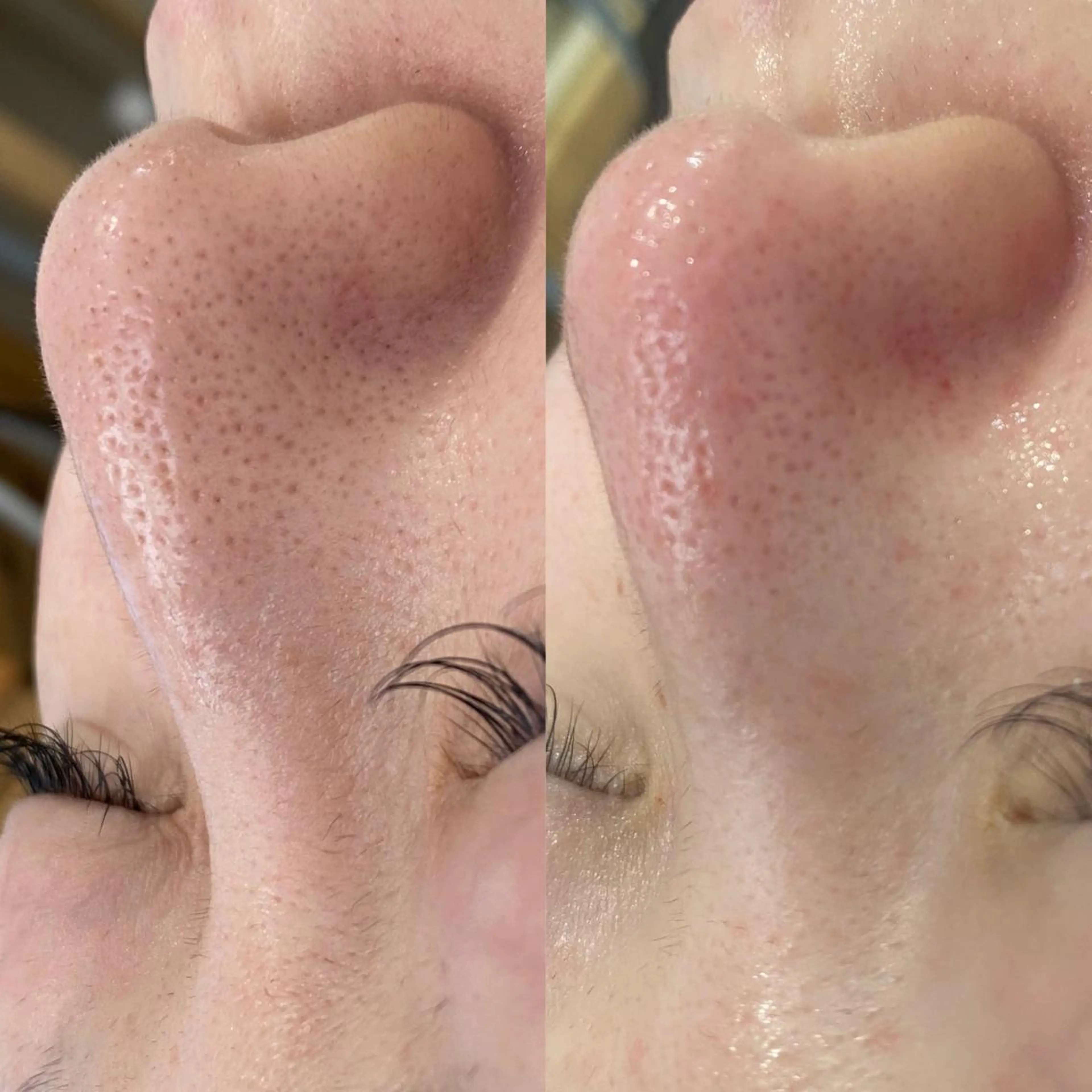 エステ Sii センター北のエステ・リラクイメージ