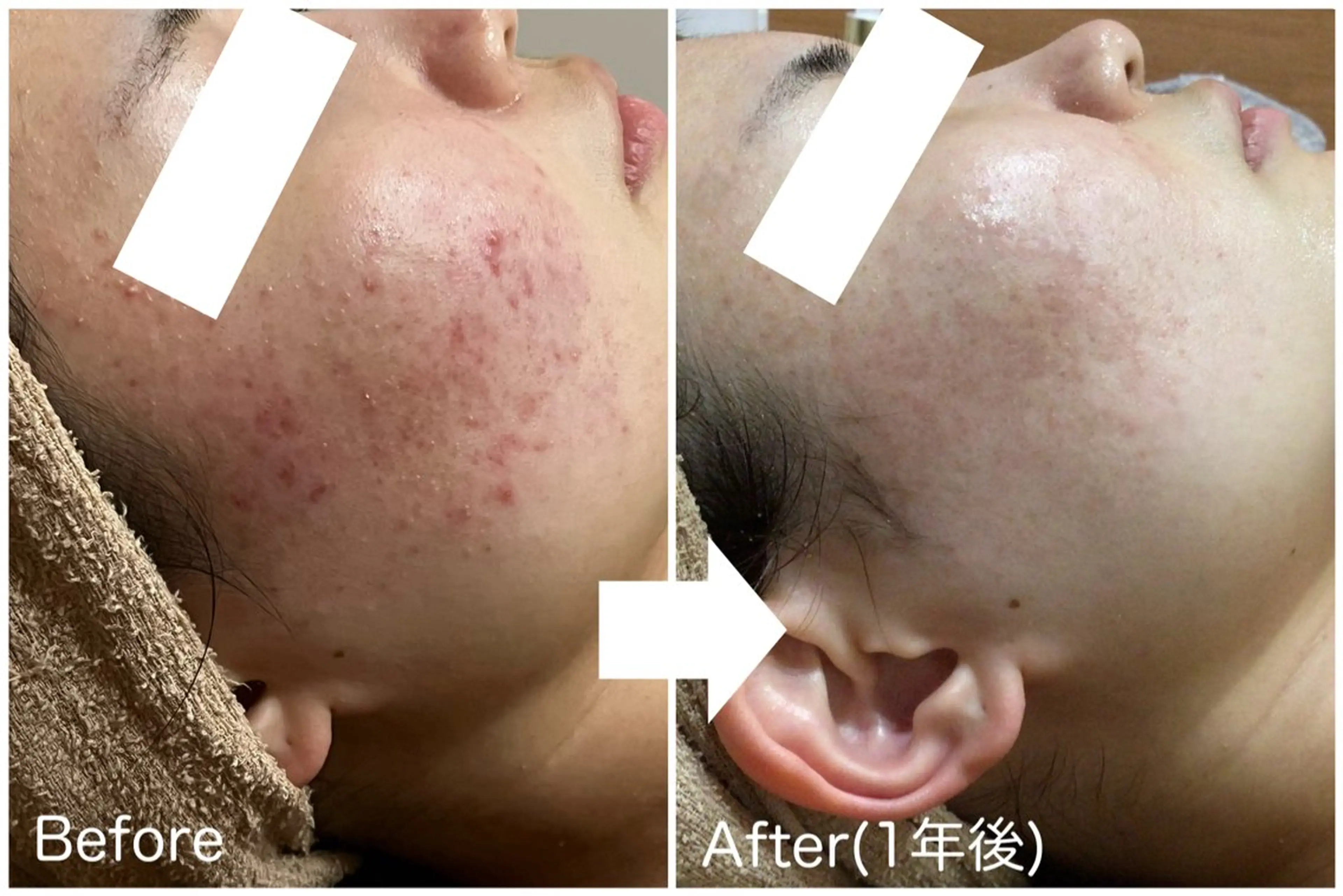 ハーブピーリング専門 muro.のエステ・リラクイメージ