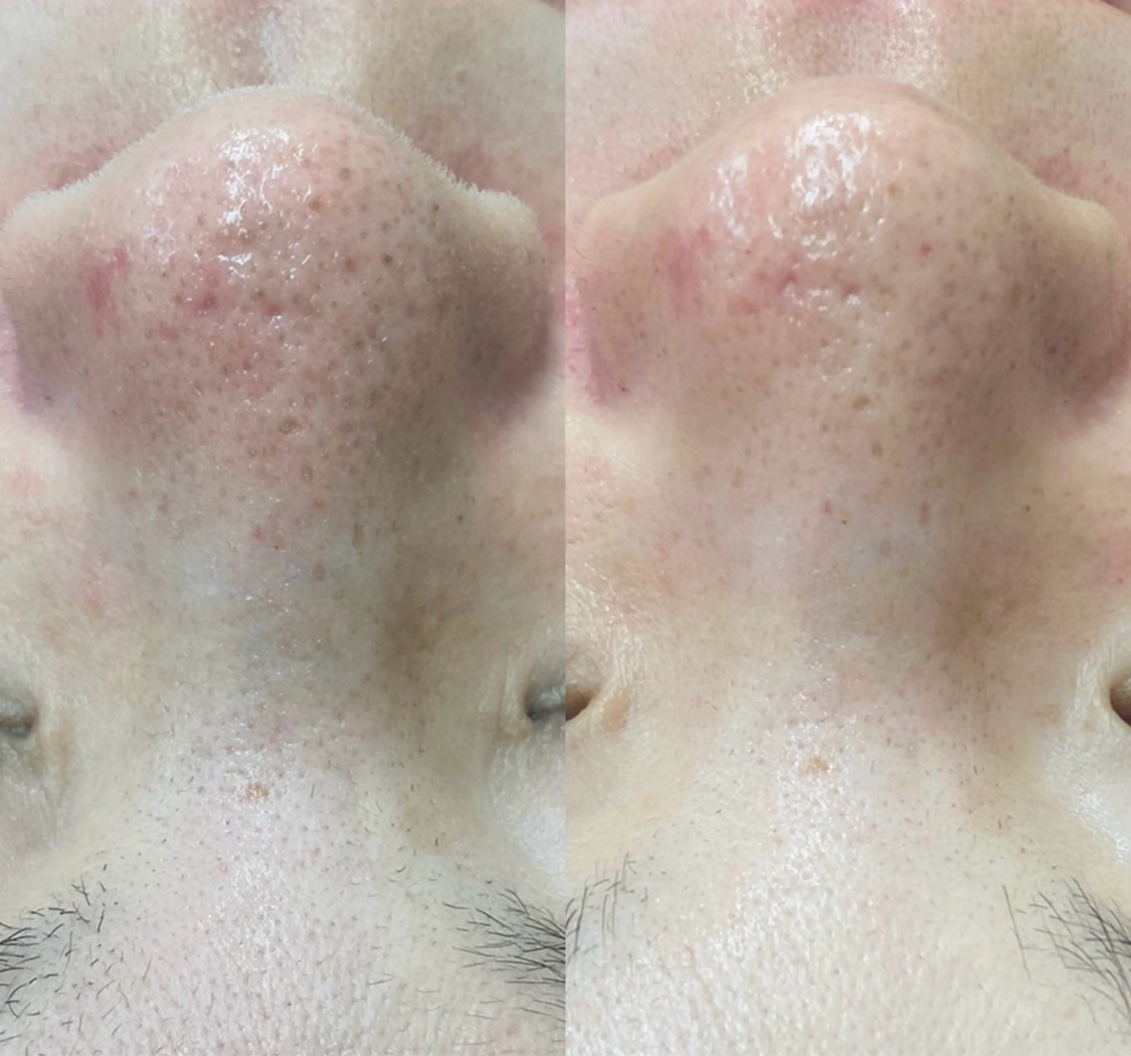 エステ RE:moom リムーム/脱毛エステのエステ・リラクイメージ