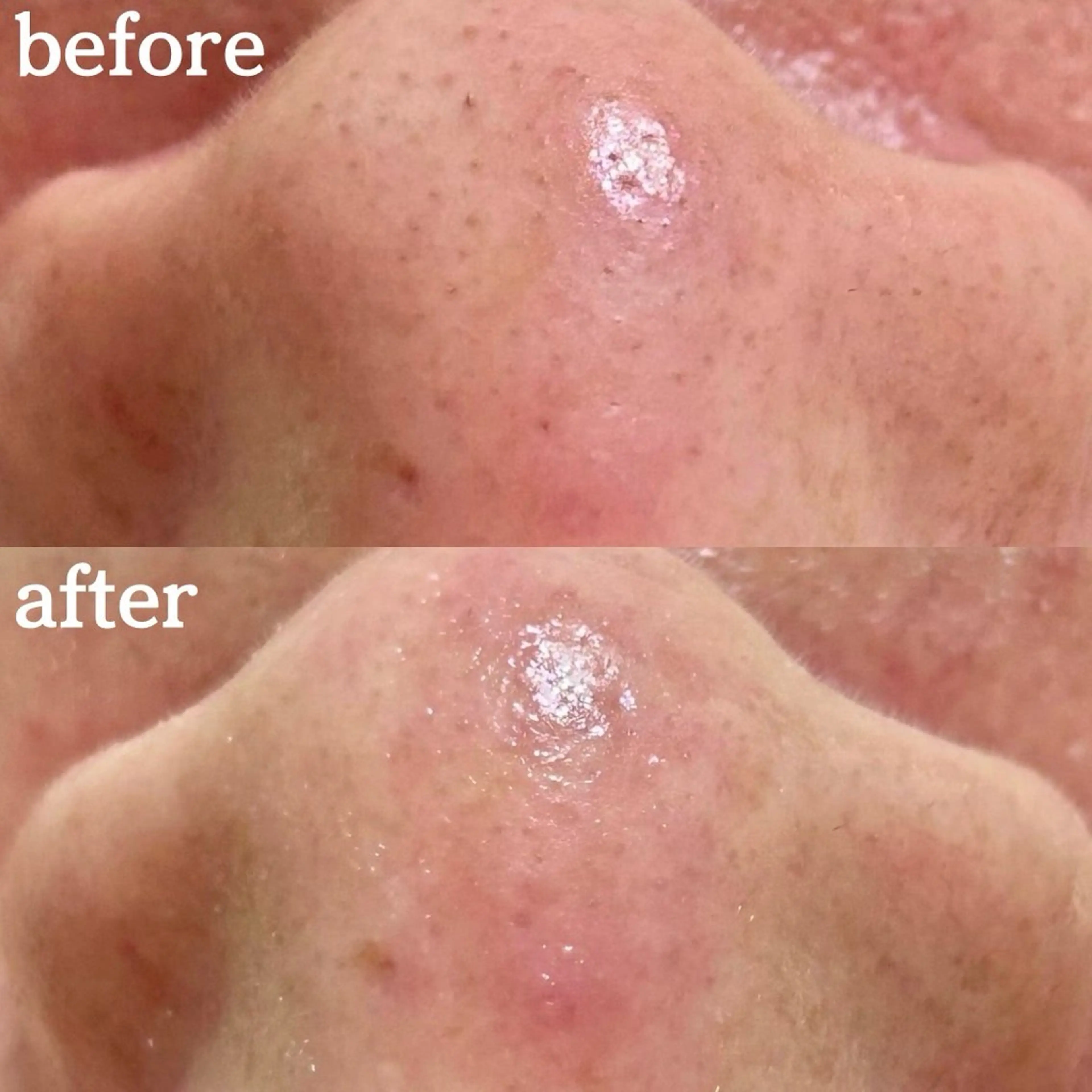 毛穴専門サロンLatiele所属・毛穴専門サロン Latieleのエステ・リラクイメージ