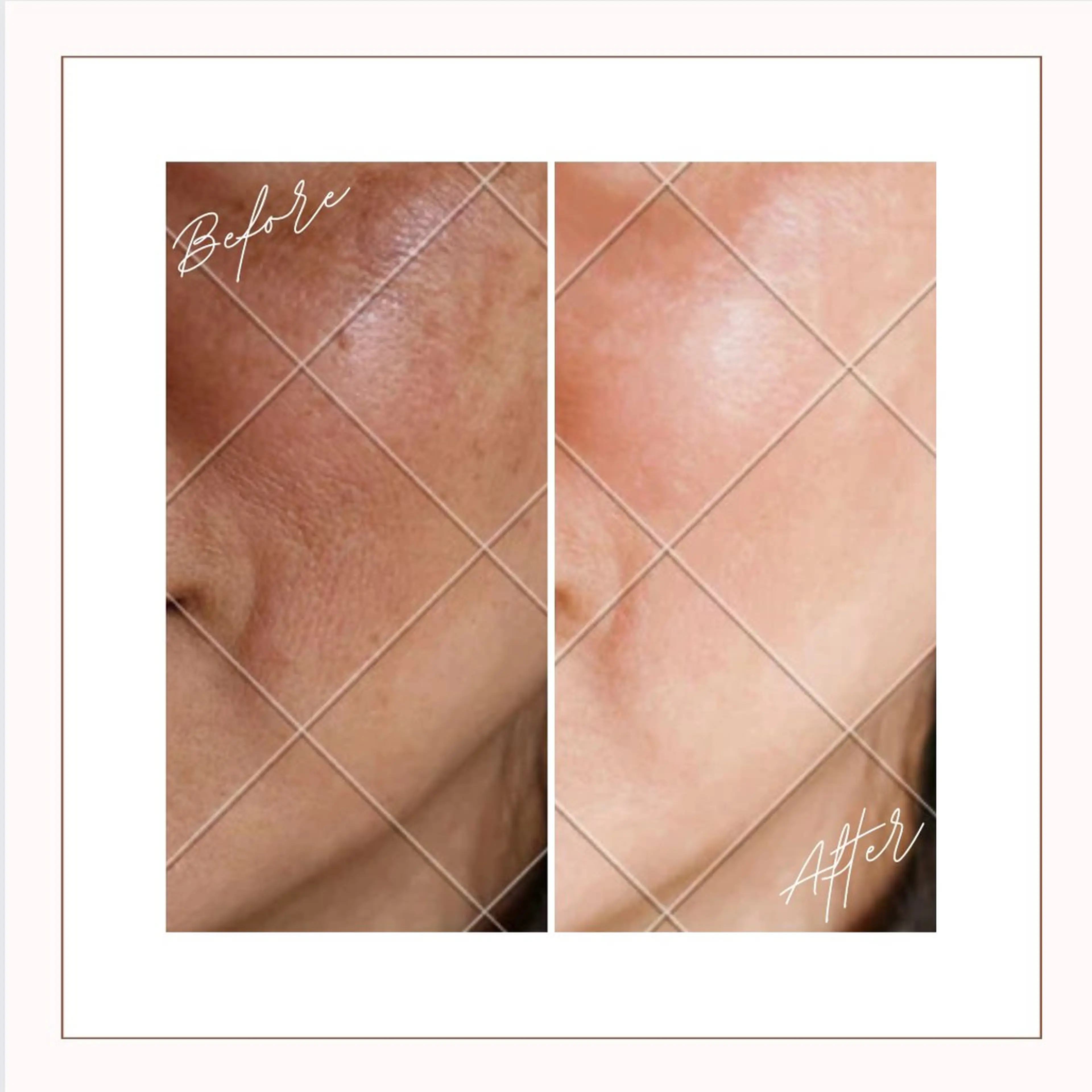 HAKUBI フェイシャルサロンのエステ・リラクイメージ