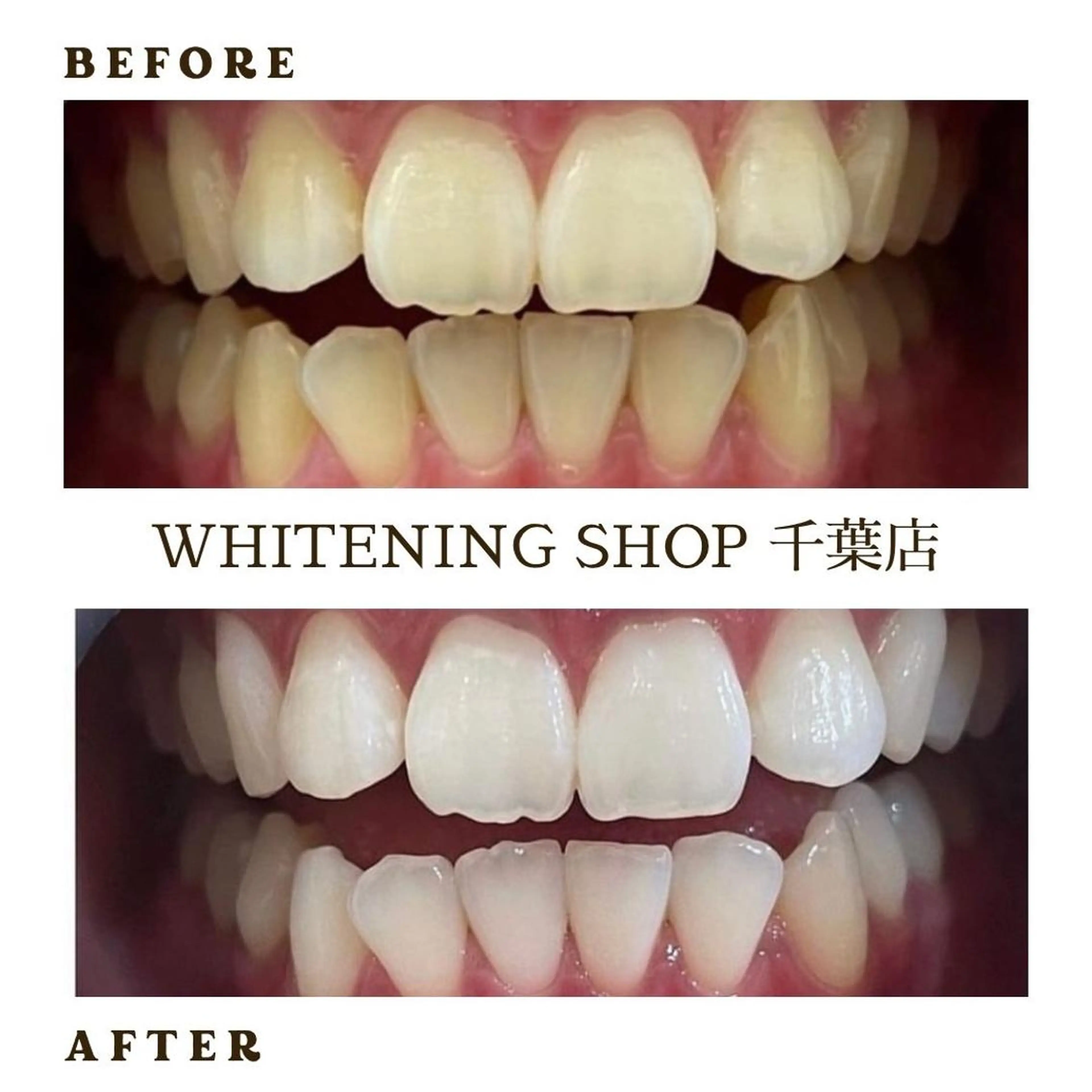 メンズ エステ ホワイトニング ショップ千葉店のその他イメージ