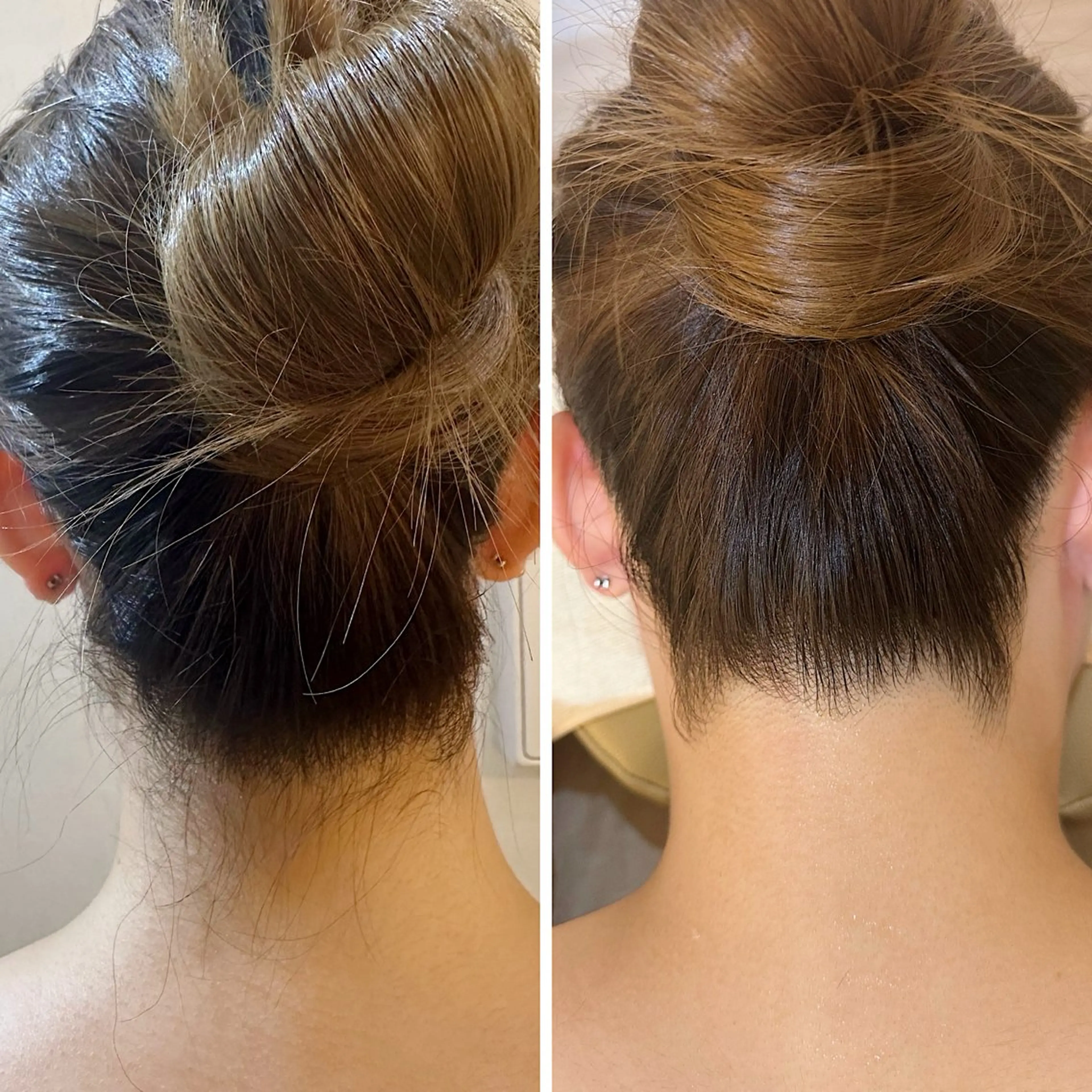 脱毛 うなじ脱毛/美肌脱毛 LABELのエステ・リラクイメージ