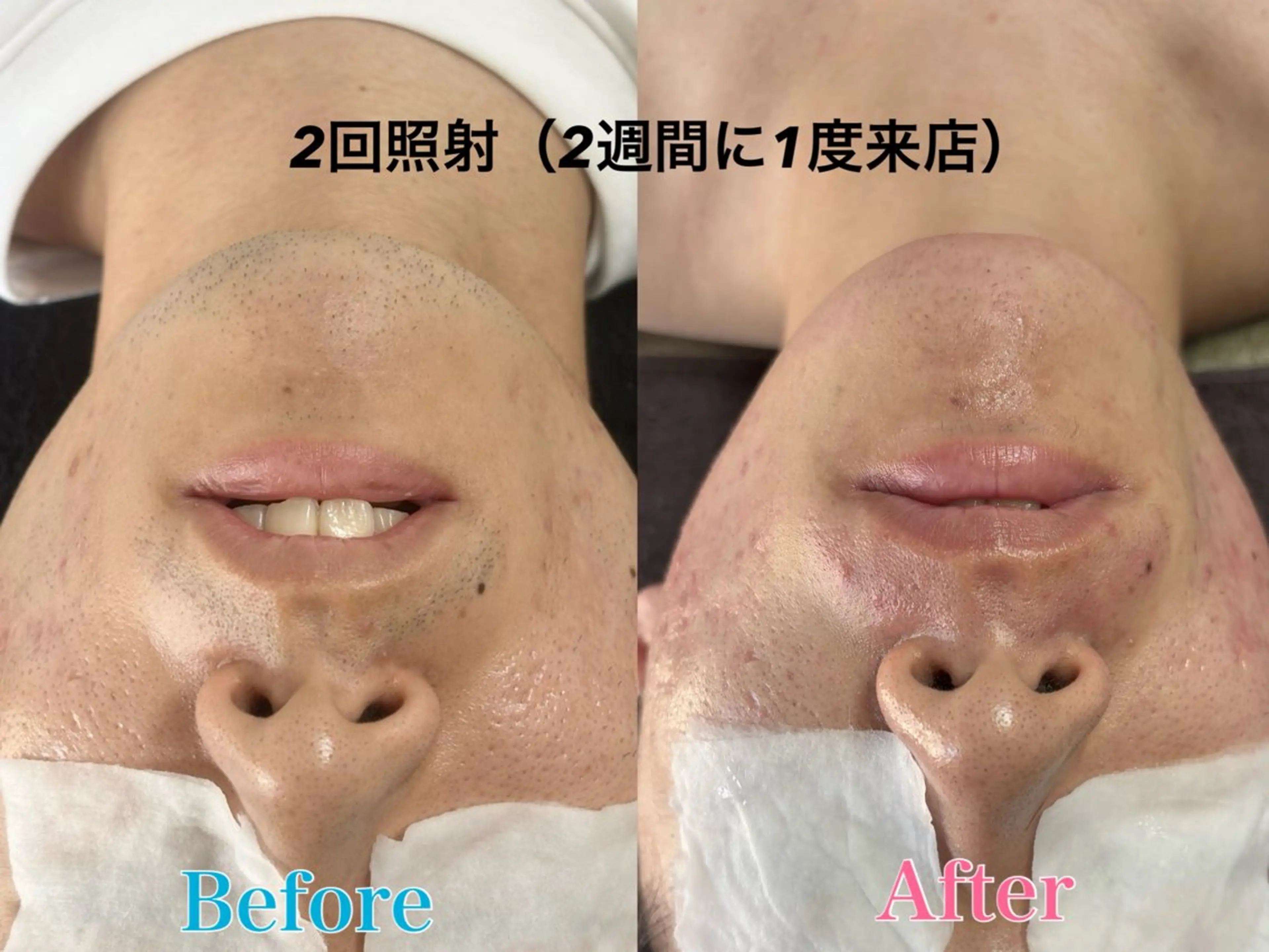 メンズ トータルビューティー サロン　Lisseの眉毛・アイブロウイメージ