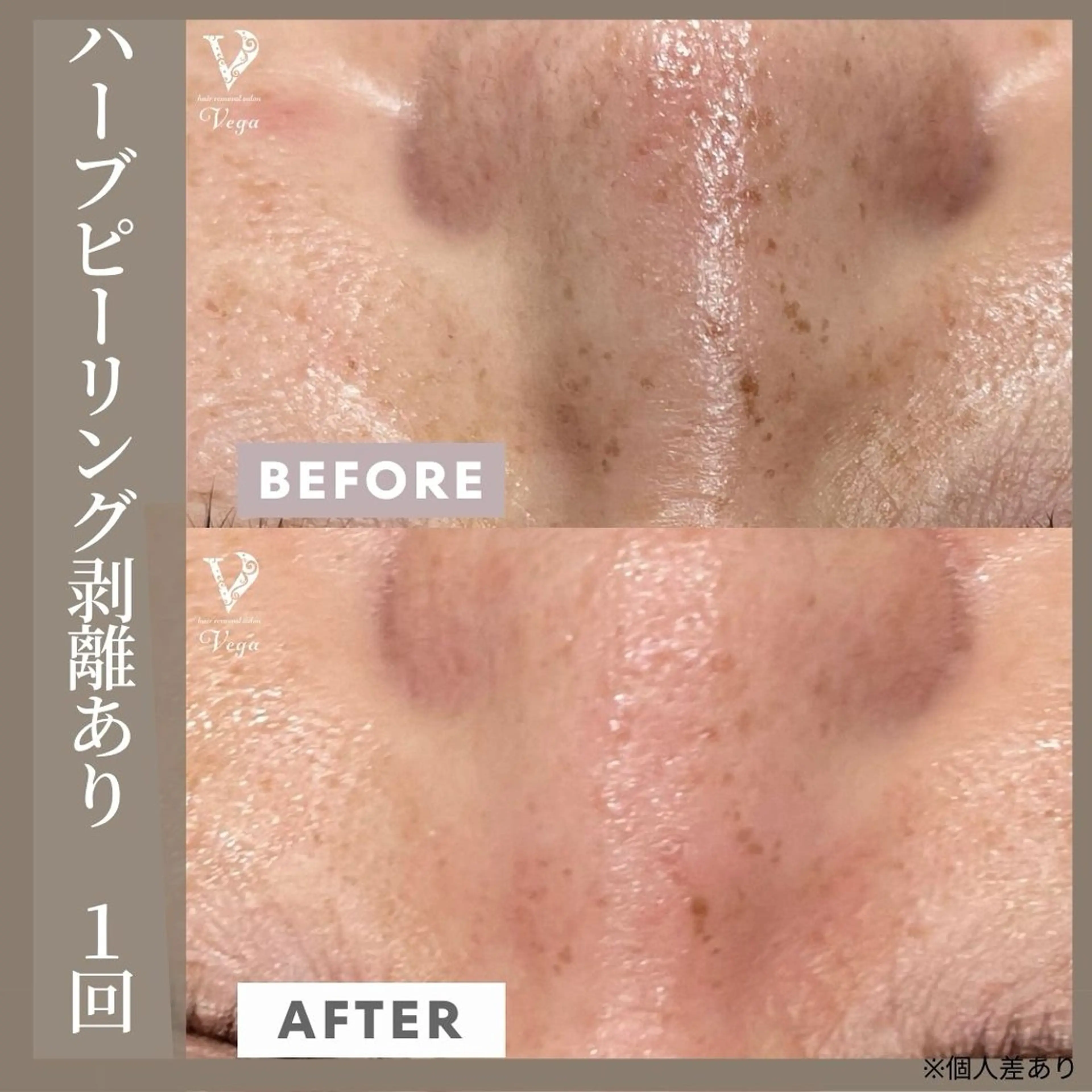 エステ サロンVega所属・店長 金光のエステ・リラクイメージ