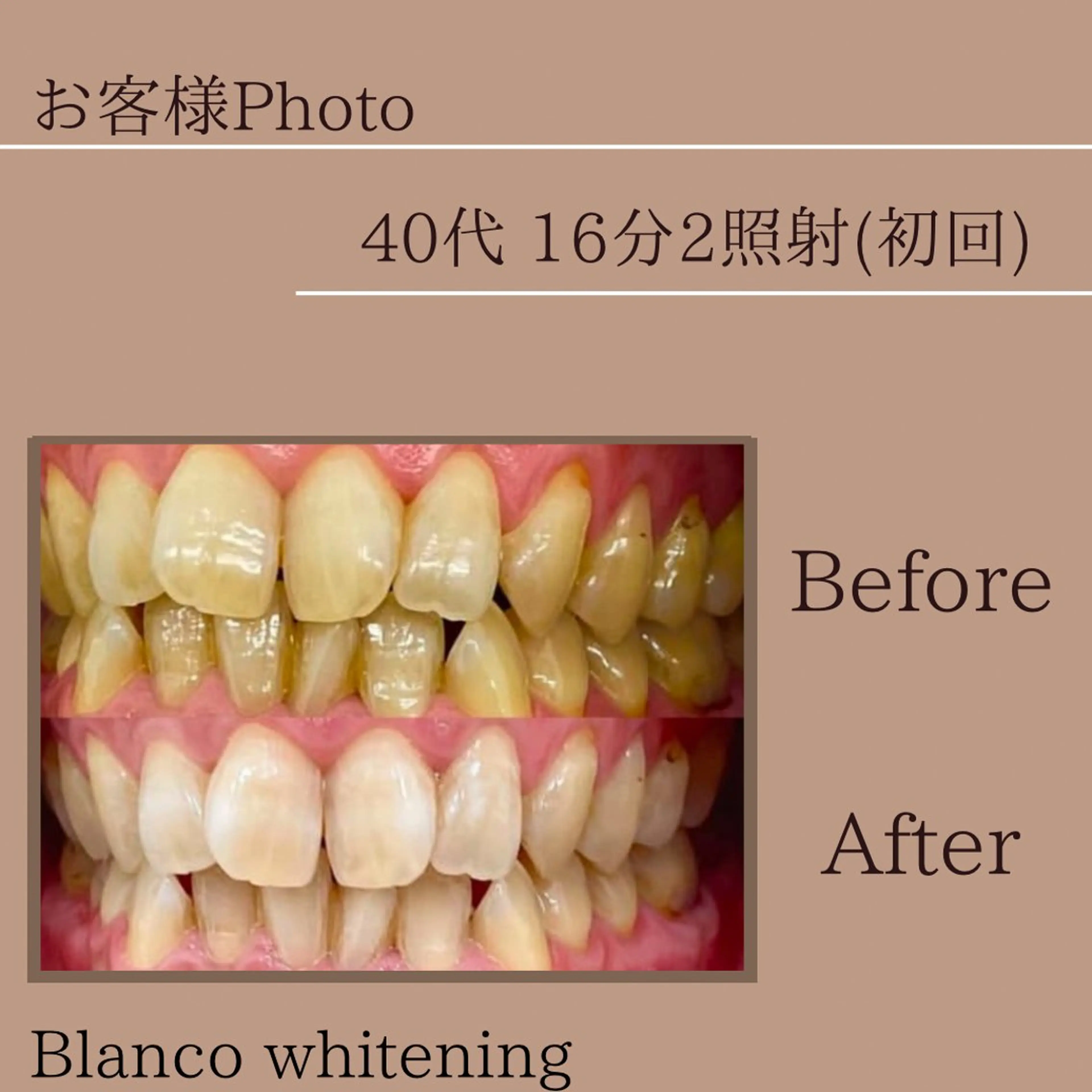 Blanco東大宮駅前店所属・blanco 東大宮駅前店のその他イメージ