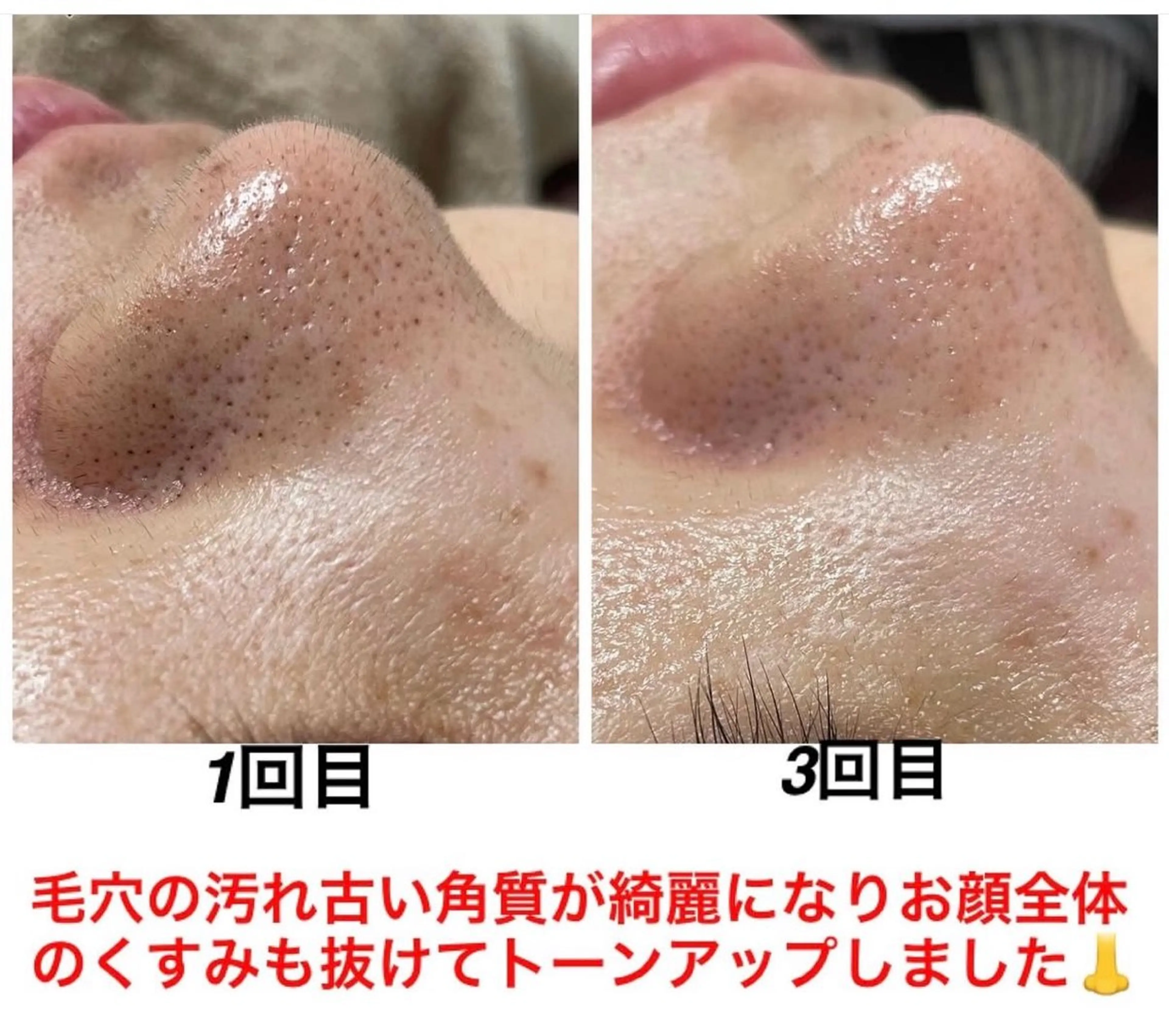 エステ リラク ネイル・エステサロンUILANI所属・ネイル・エステサロン UILANIのネイルデザイン