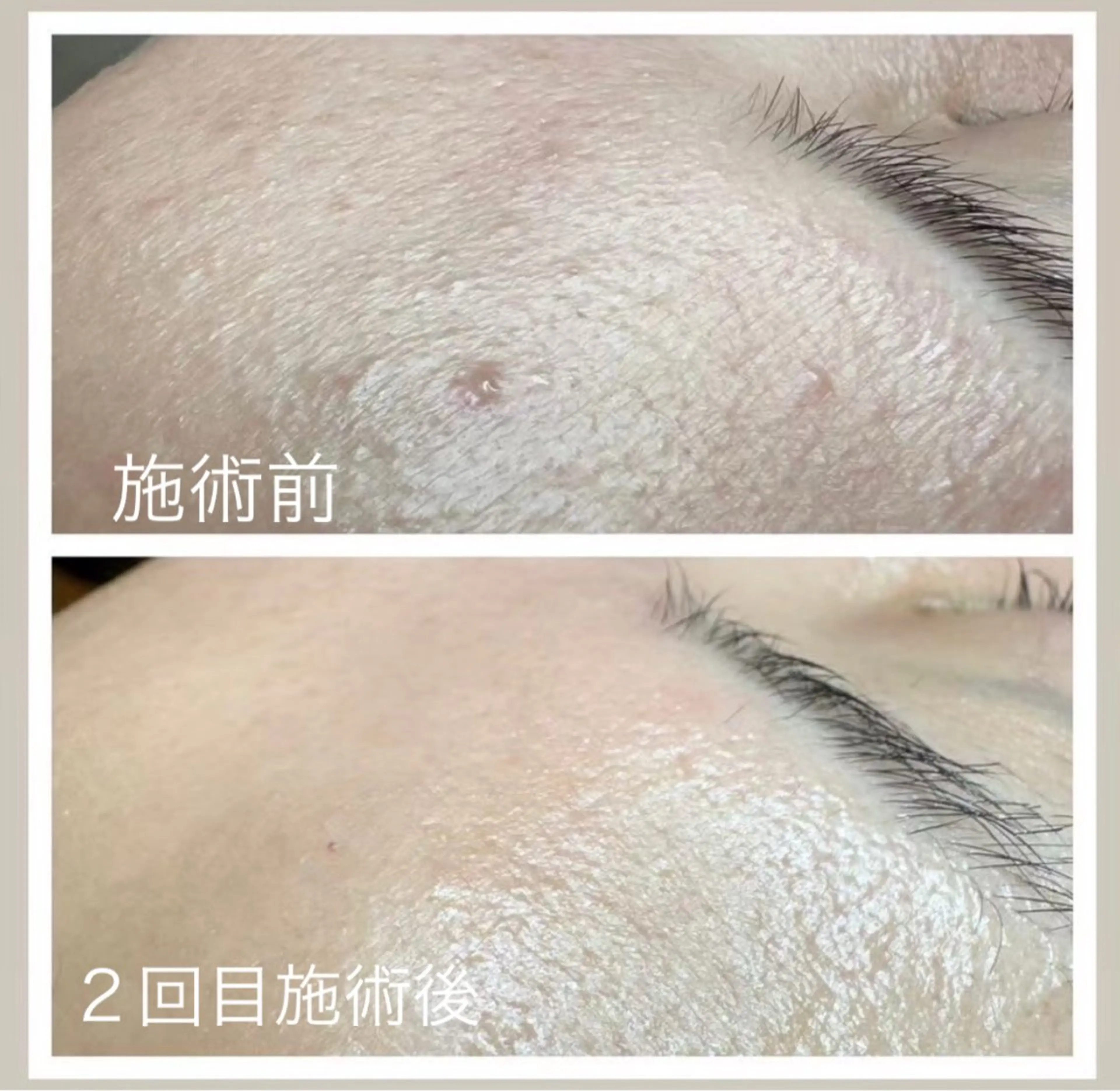 エステ スリーエスプラス内　美肌サロンEme所属・希映 -kieのエステ・リラクイメージ