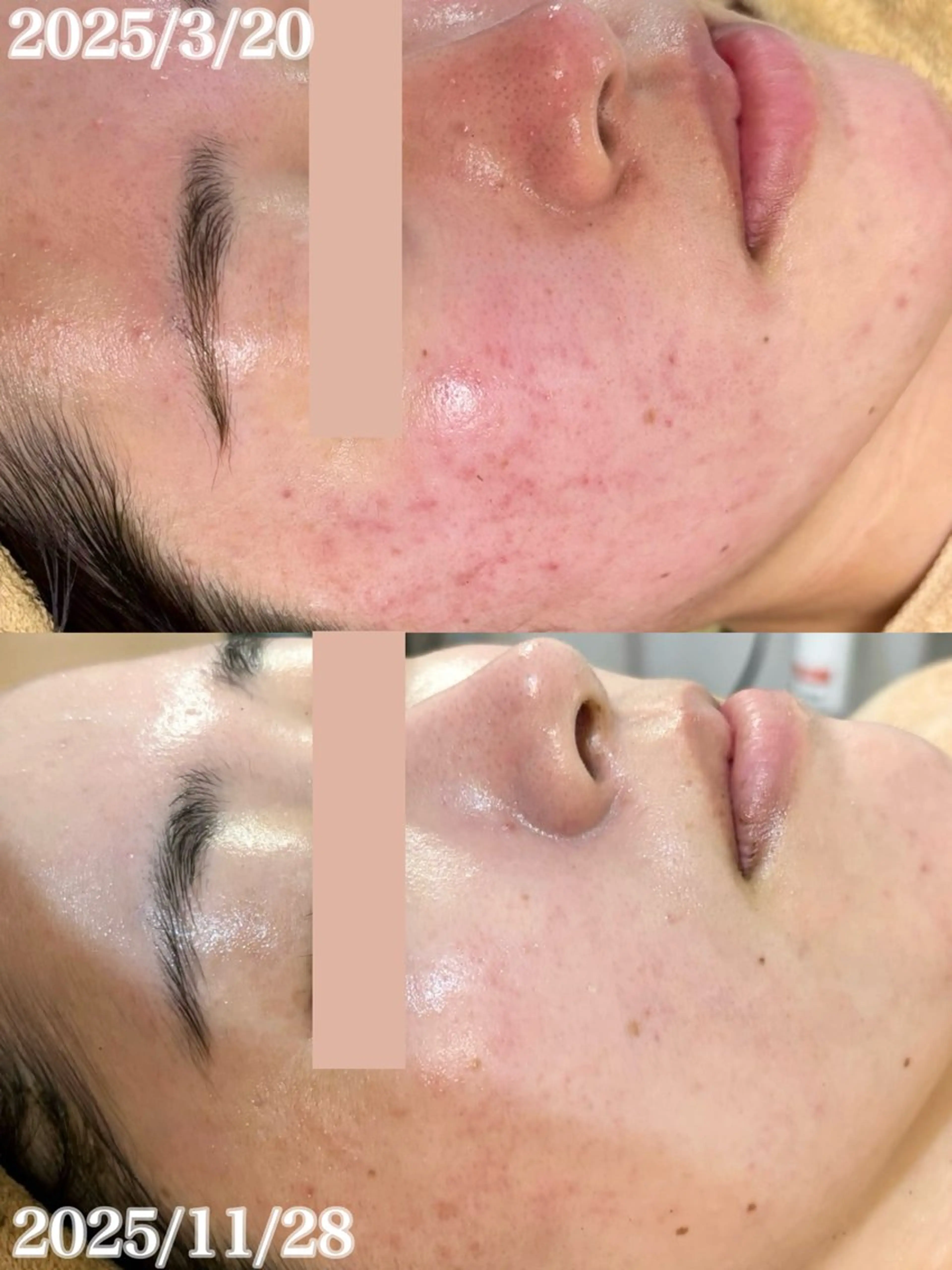 エステ WHITE AQUA 北千住店のエステ・リラクイメージ