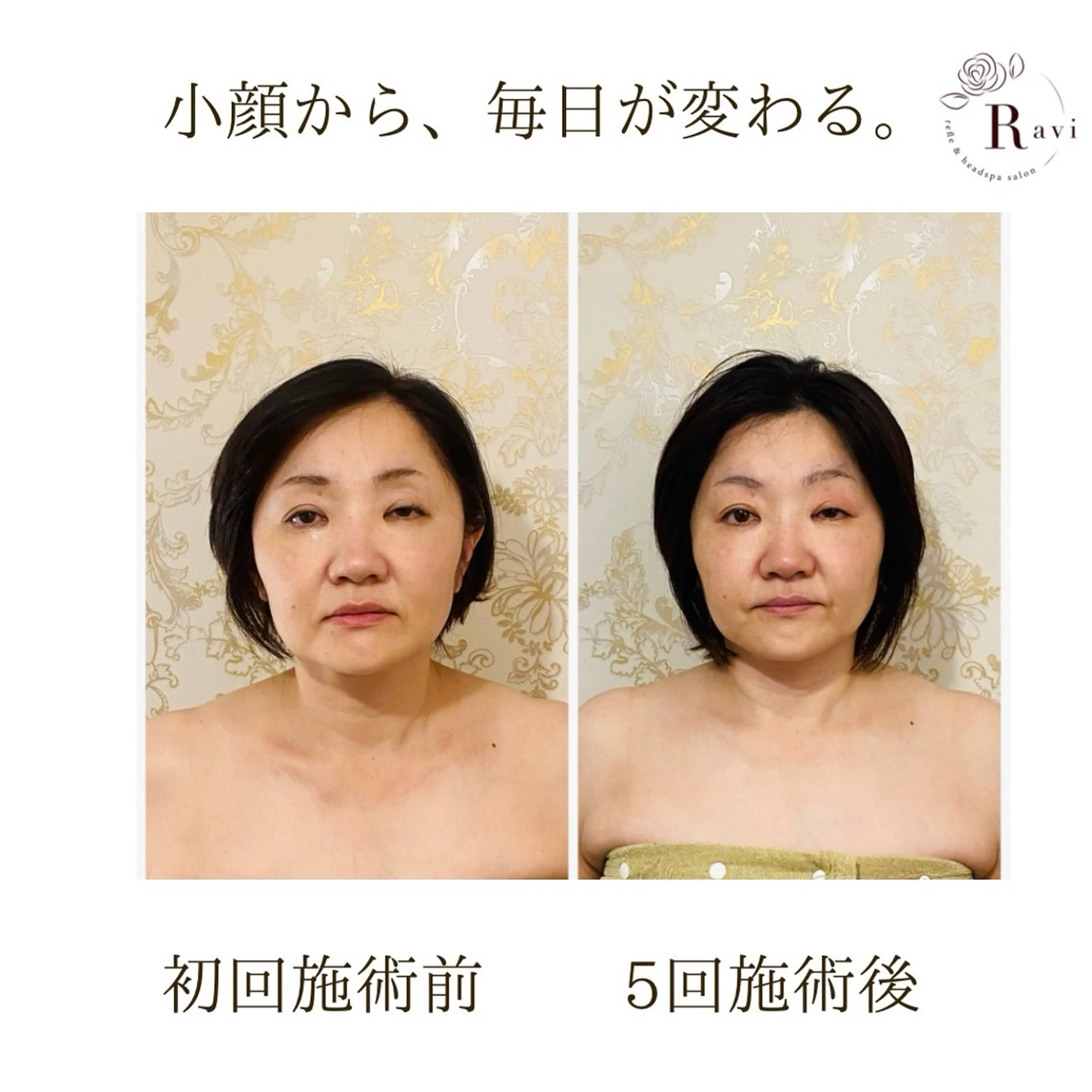 小顔サロンラヴィ　　船橋馬込沢店所属・小顔サロンラヴィ 船橋のエステ・リラクイメージ