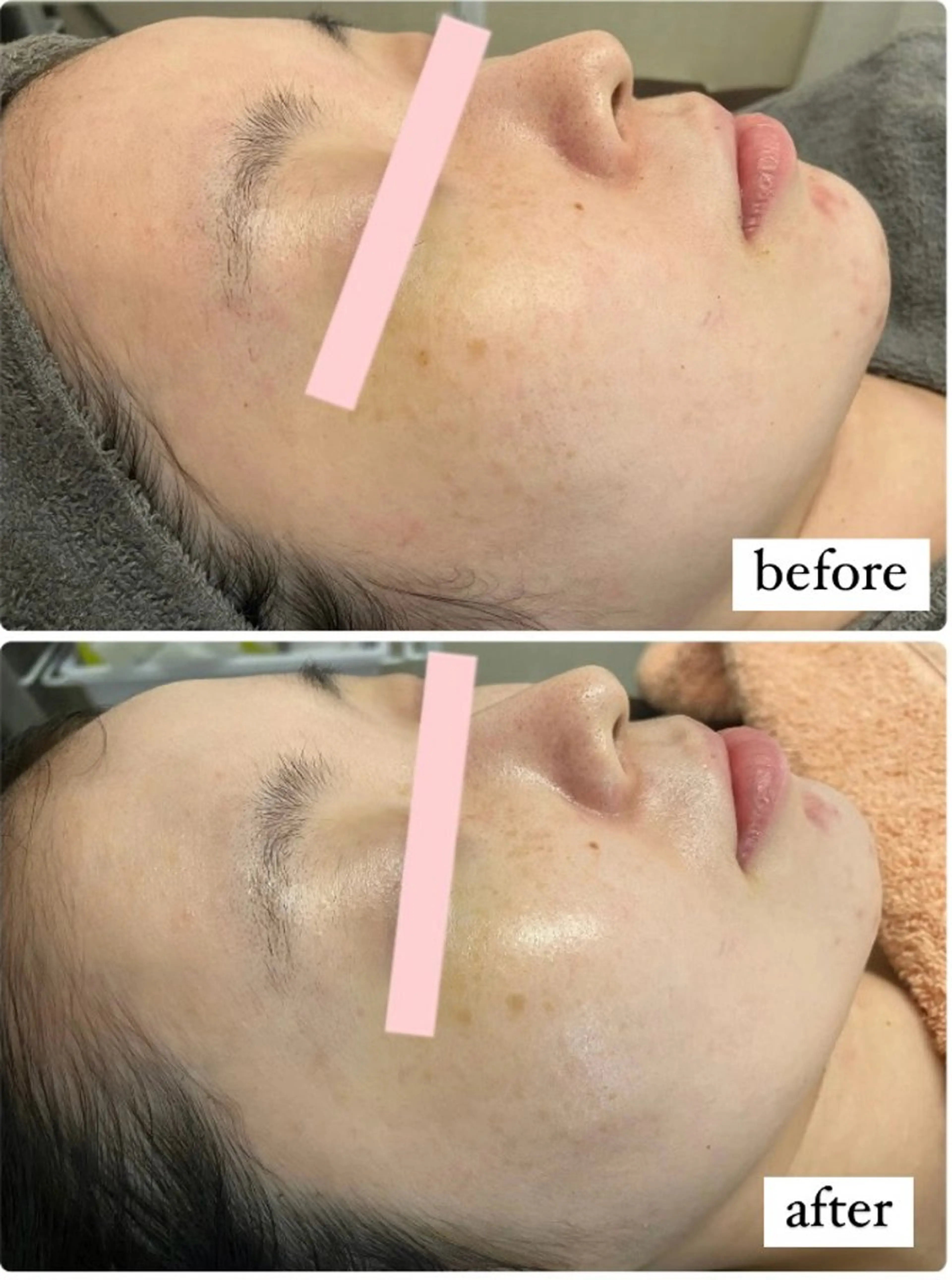 エステ リラク Monart -deux-のエステ・リラクイメージ