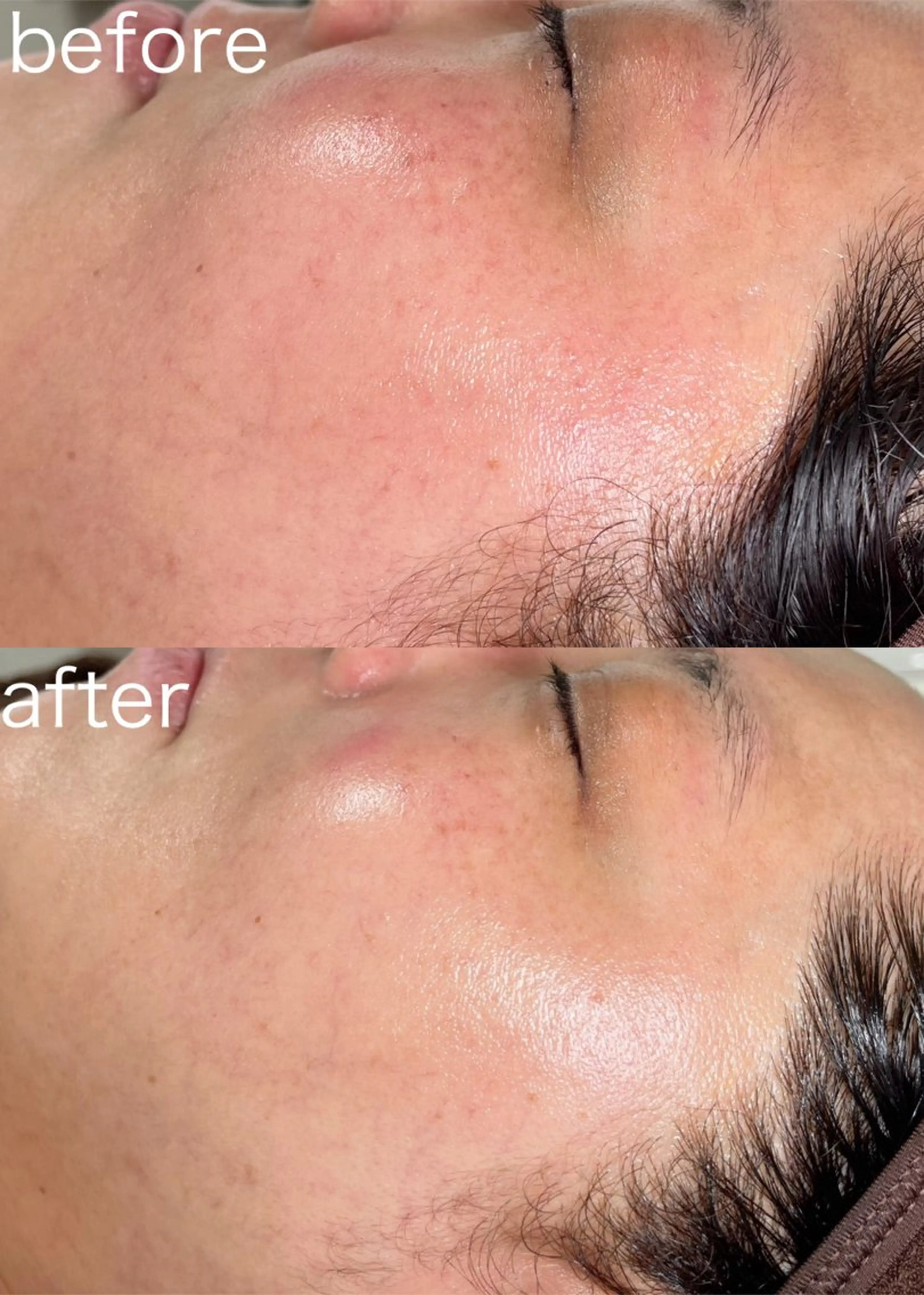 医療提携Beauty SalonMuseのエステ・リラクイメージ