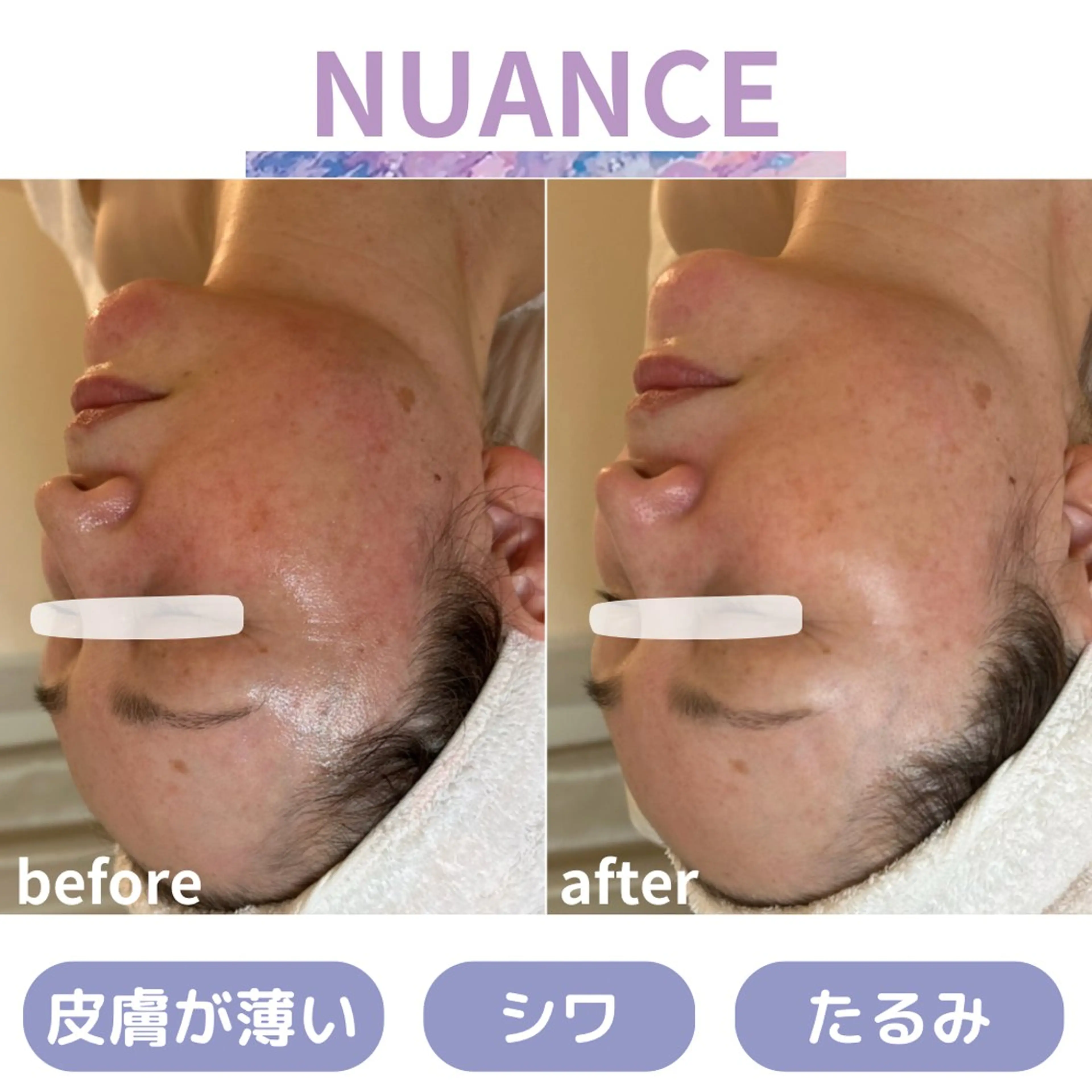 【シワ・ハリ感UP🕊】皮膚の薄さに着目した再生ケア✦ニュアンス|クリスティーナ天王寺・大阪💎の写真