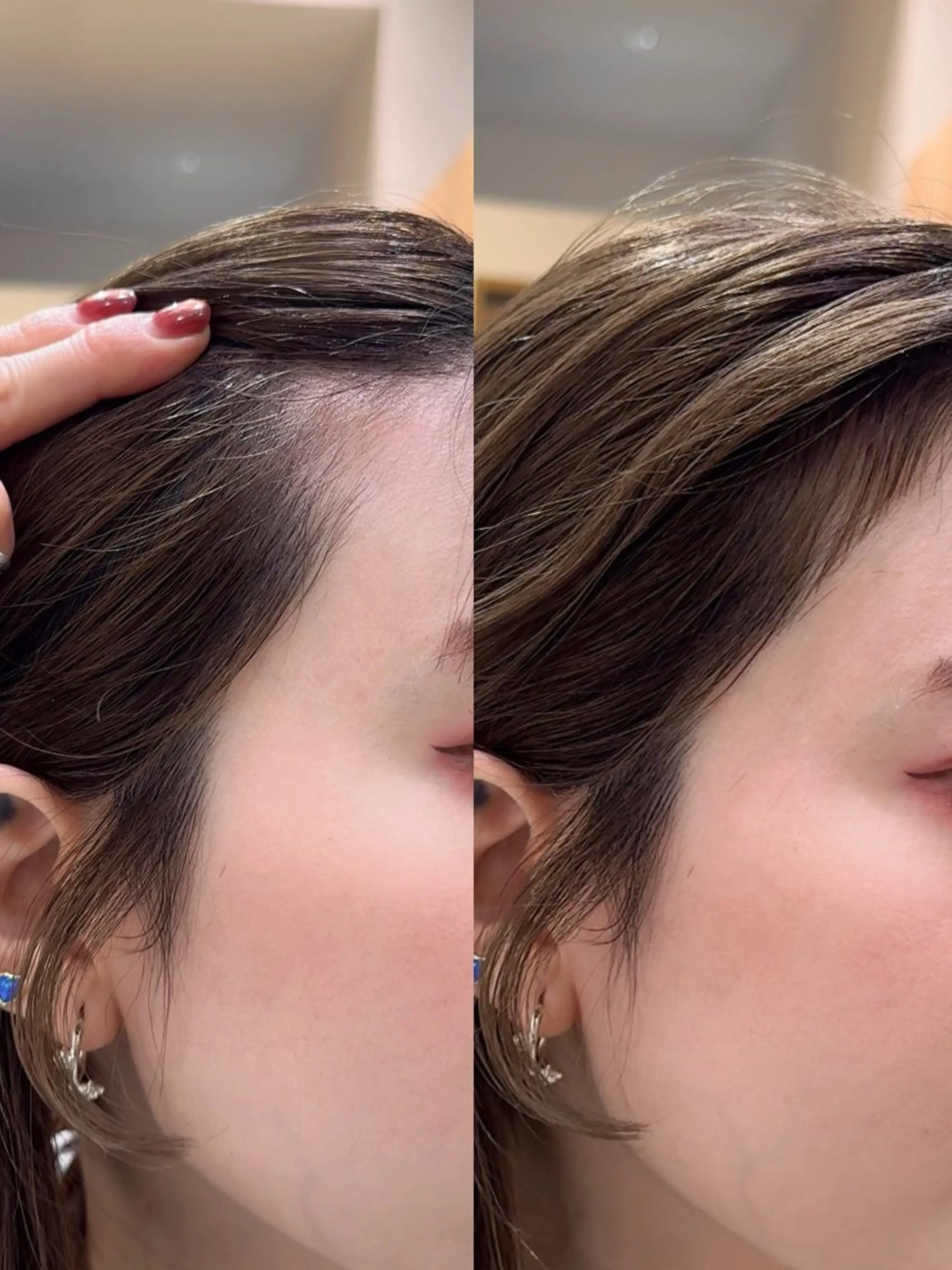 骨格補正うぶ毛カット🎀お禿げを解消します🫶🏻🫧シャンプーブローなし💫の写真