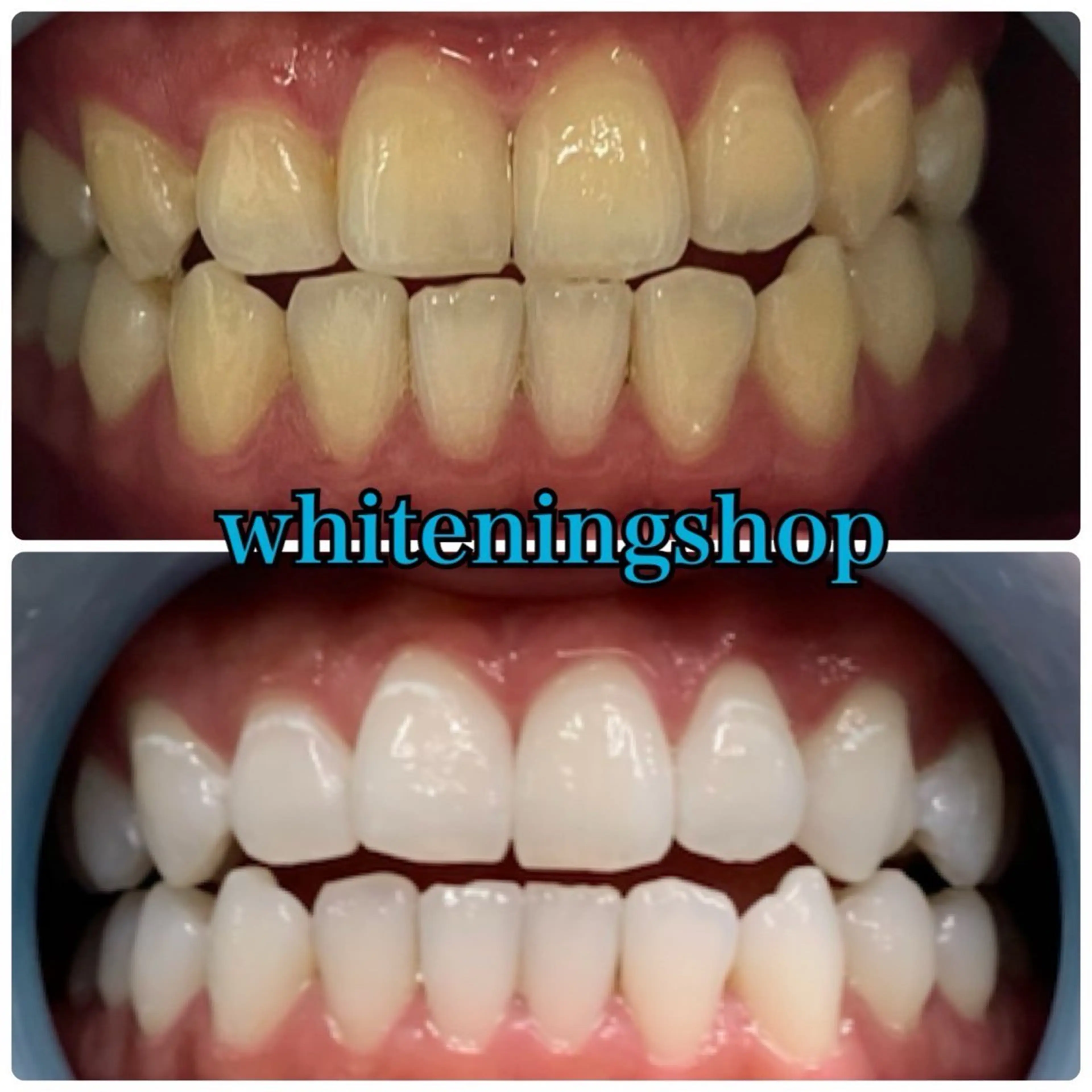 メンズ エステ リラク ホワイトニング ショップ川越店のエステ・リラクイメージ