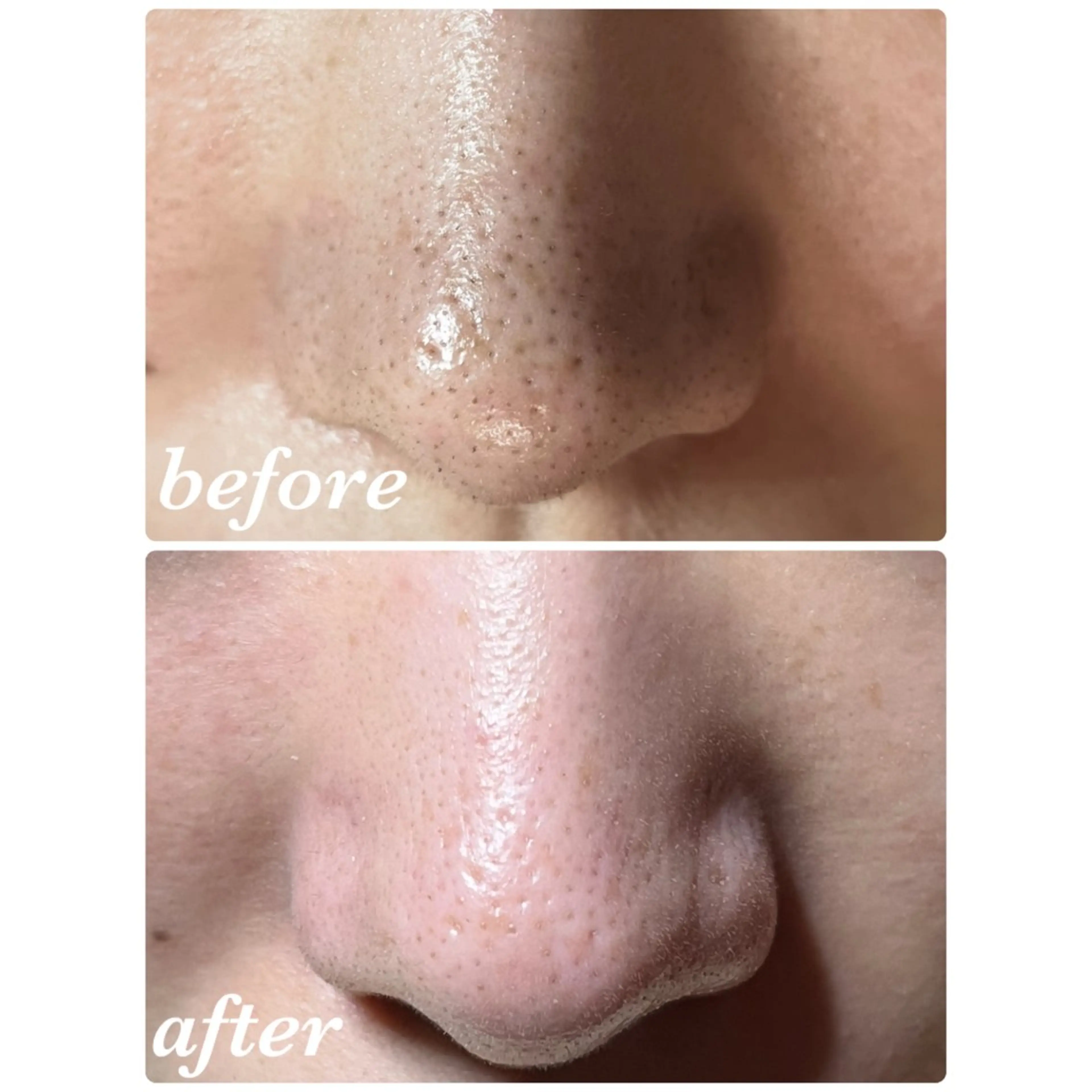 エステ リラク 結果重視｜毛穴エステ ｜友綱理恵のエステ・リラクイメージ