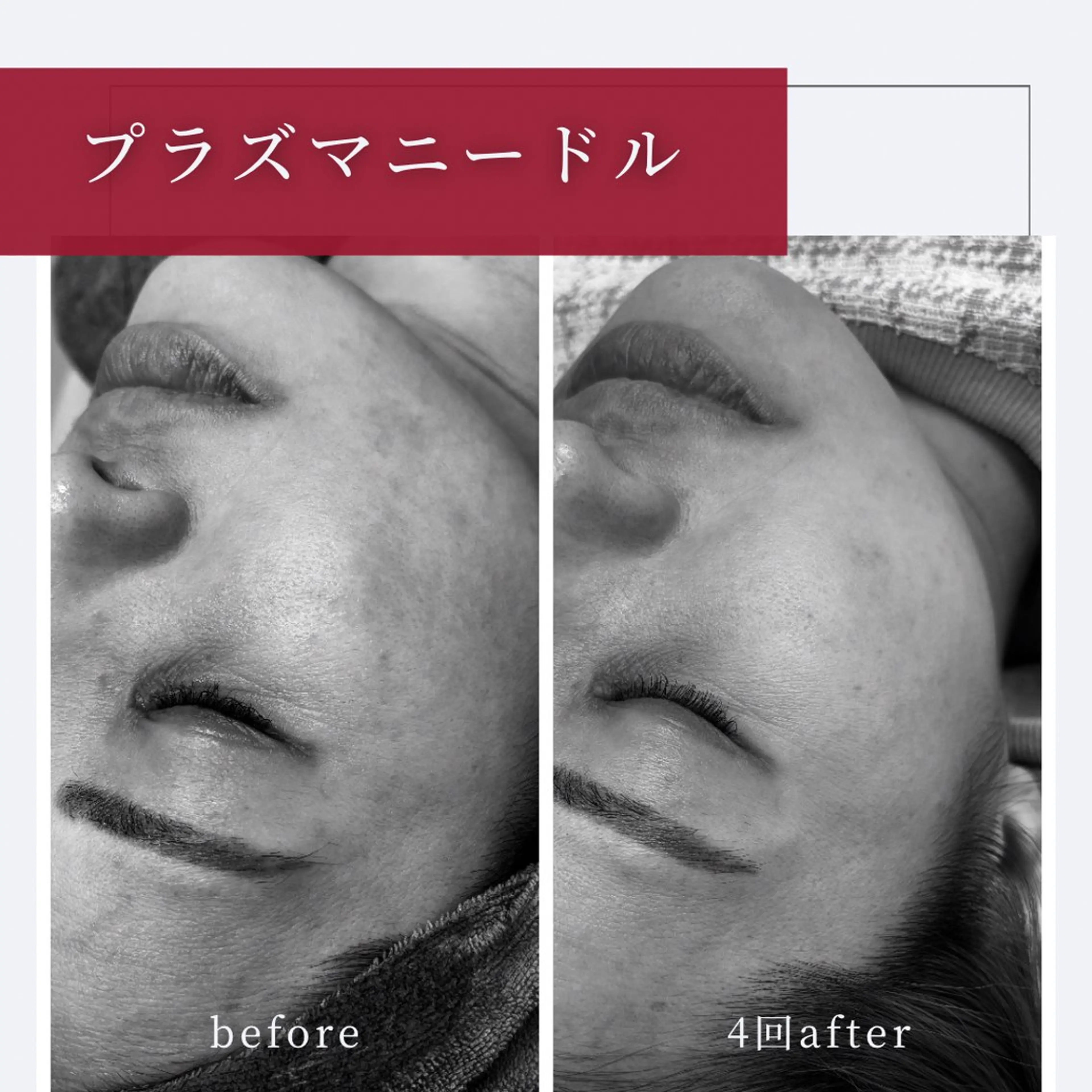 エステ 小顔矯正専門店 【RED】池田のエステ・リラクイメージ