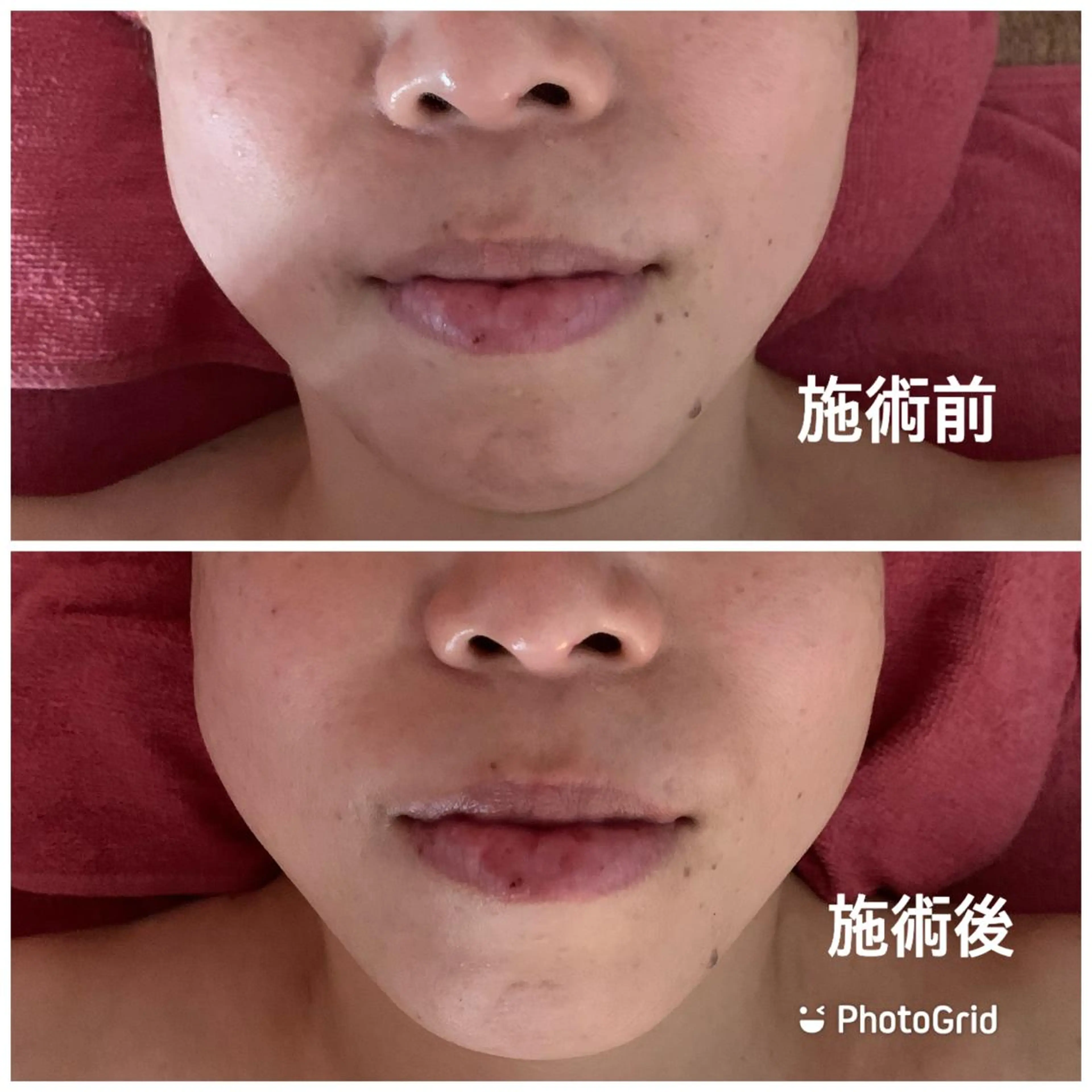 LUCIALL  ルシアル所属・児玉 愛由美のエステ・リラクイメージ