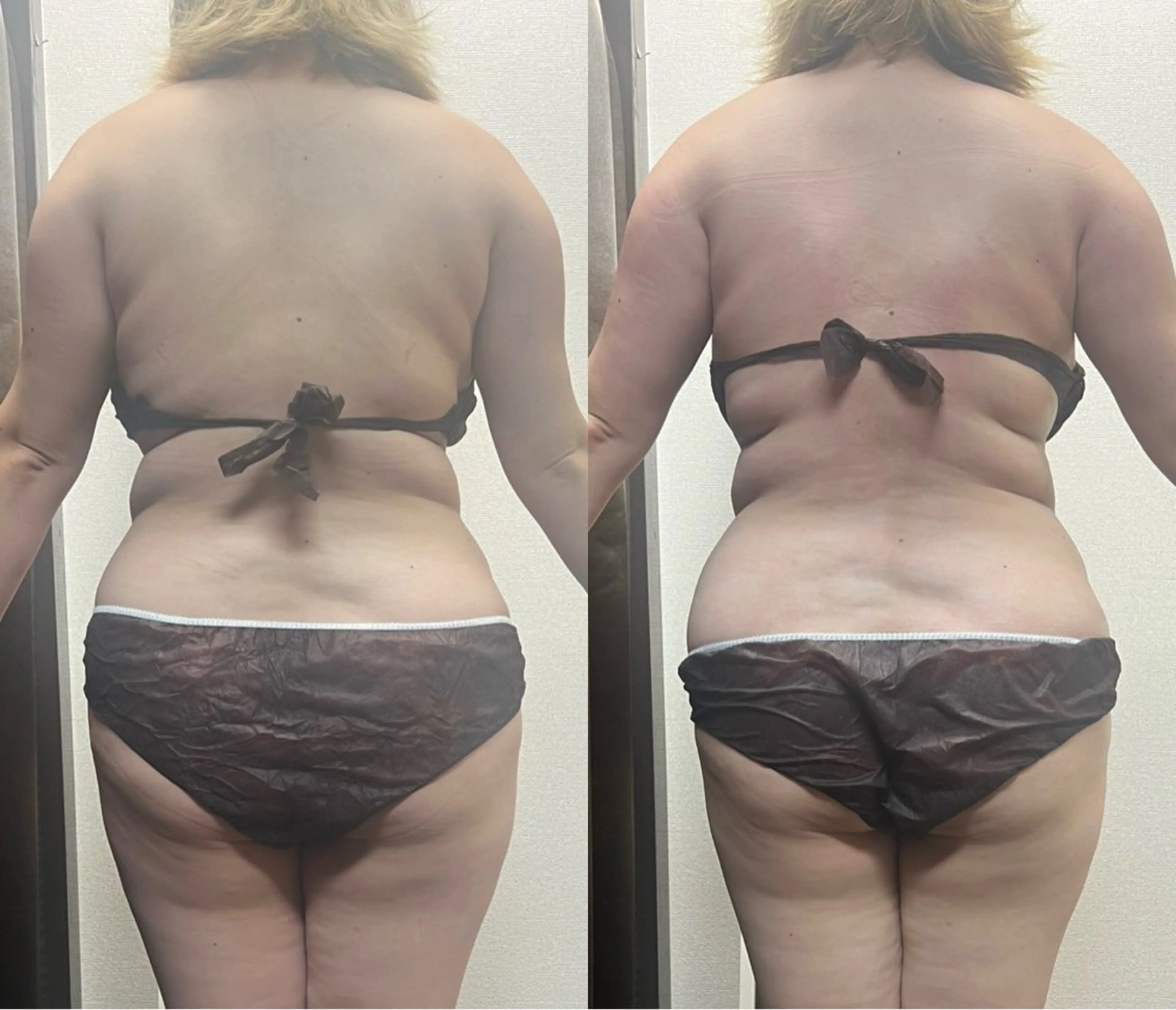 エステ ハイパーナイフ専門店　Salon de COCO所属・Salon de COCOのエステ・リラクイメージ