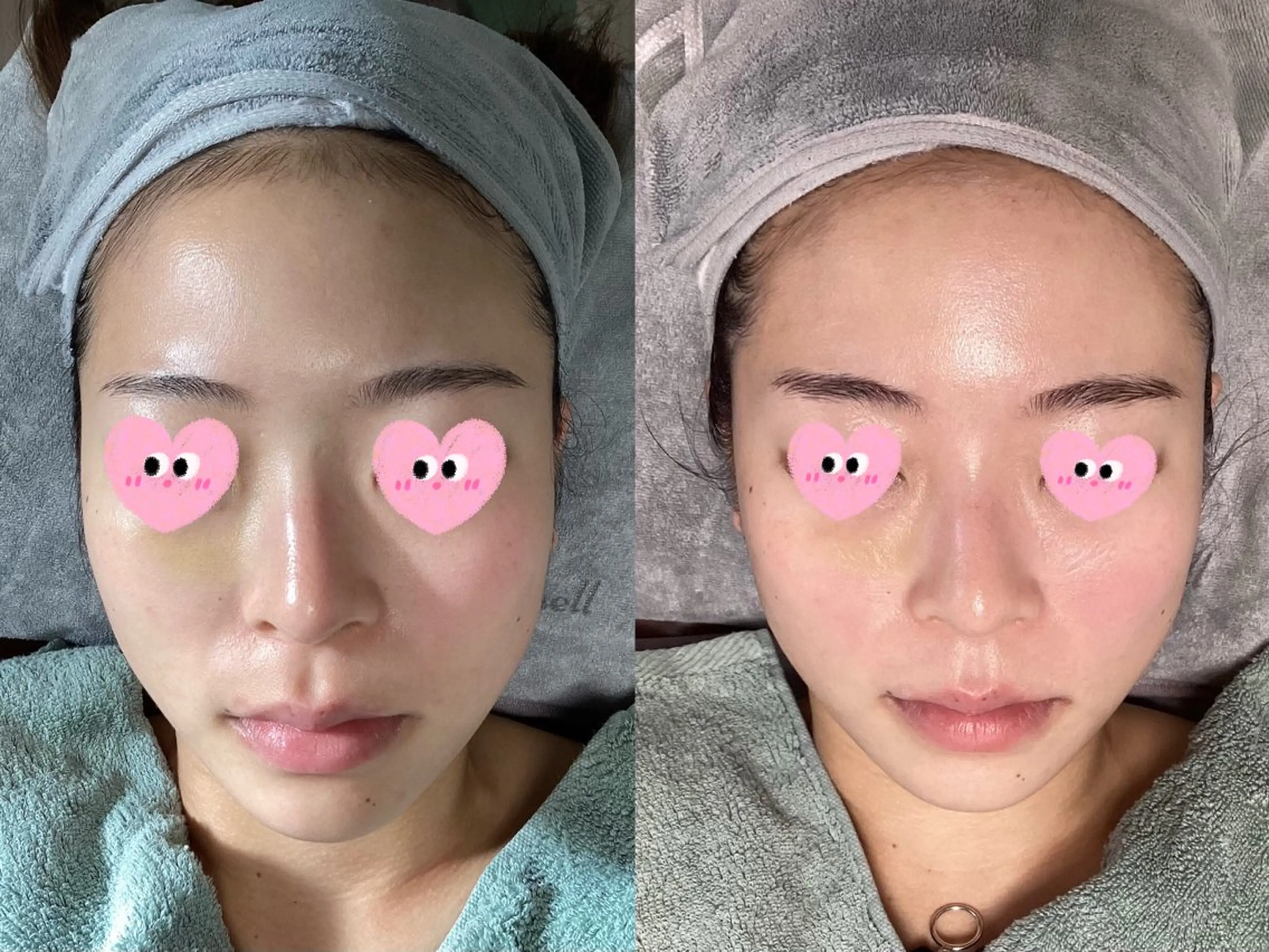 エステ リラク ホワイティアビシェル ウラワ　白澤奇のその他イメージ