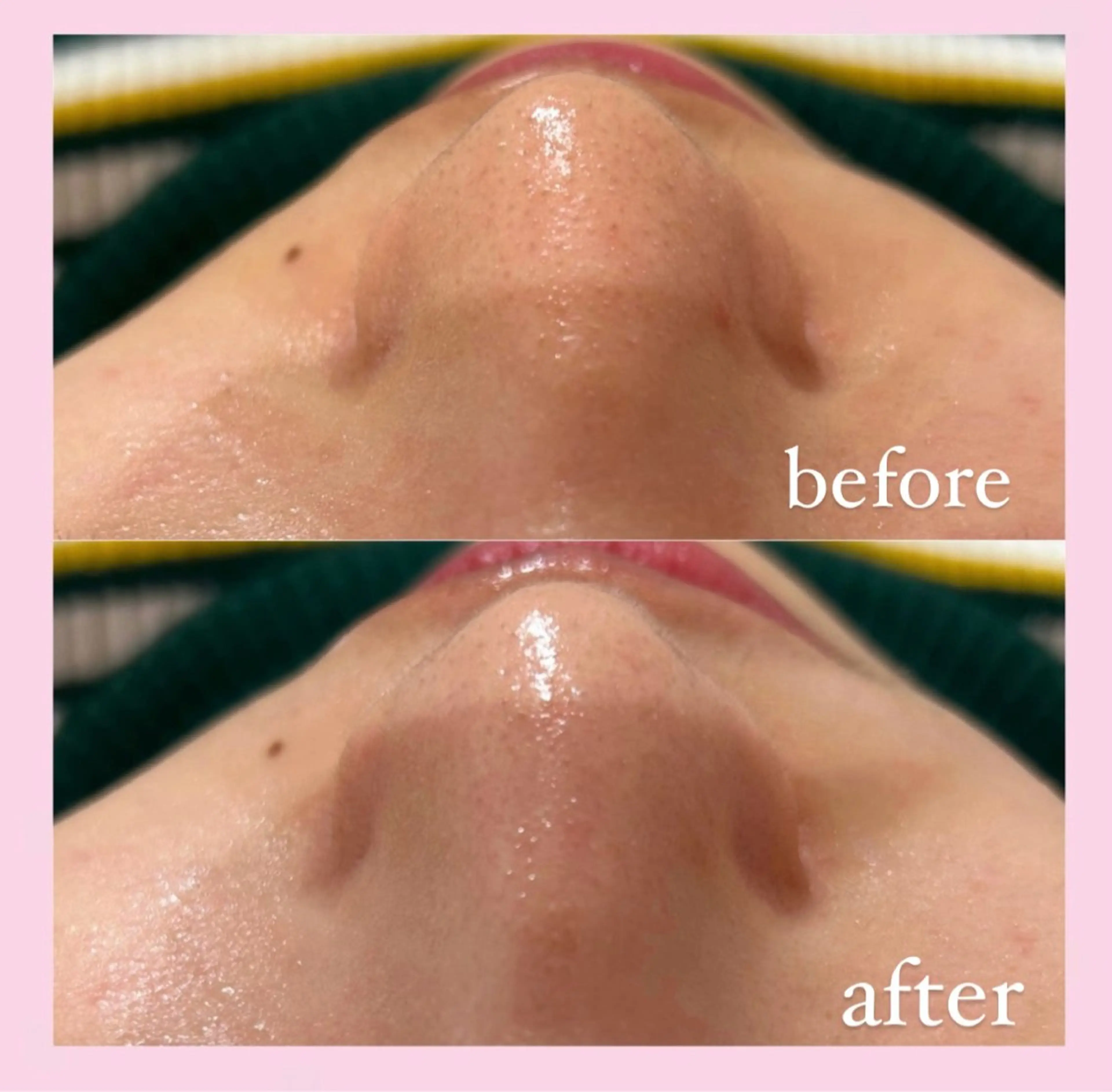 エステ 韓国肌管理専門店　White labo 宝塚店所属・有川 凜のエステ・リラクイメージ