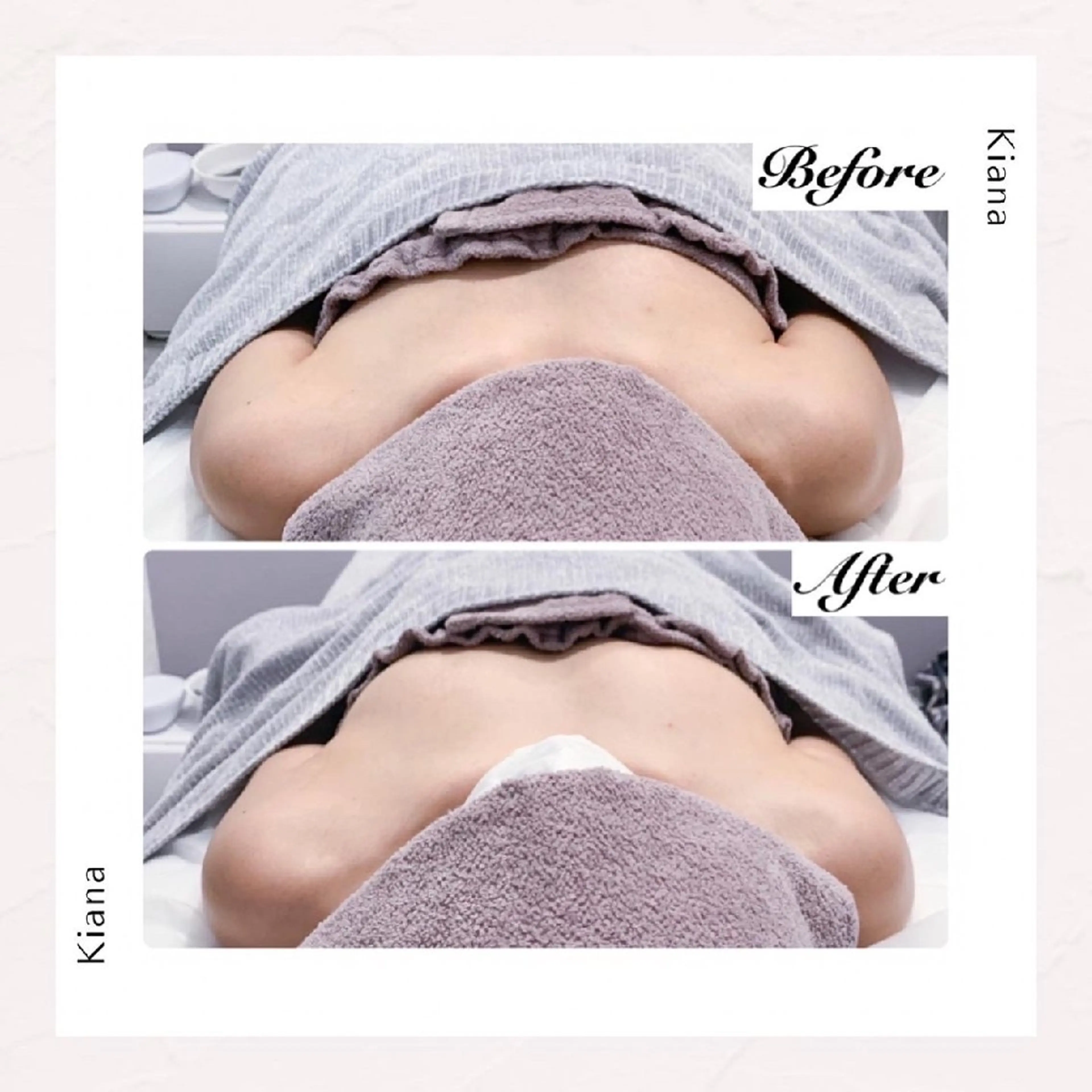 【バスト専門店 】 Kiana のエステ・リラクイメージ