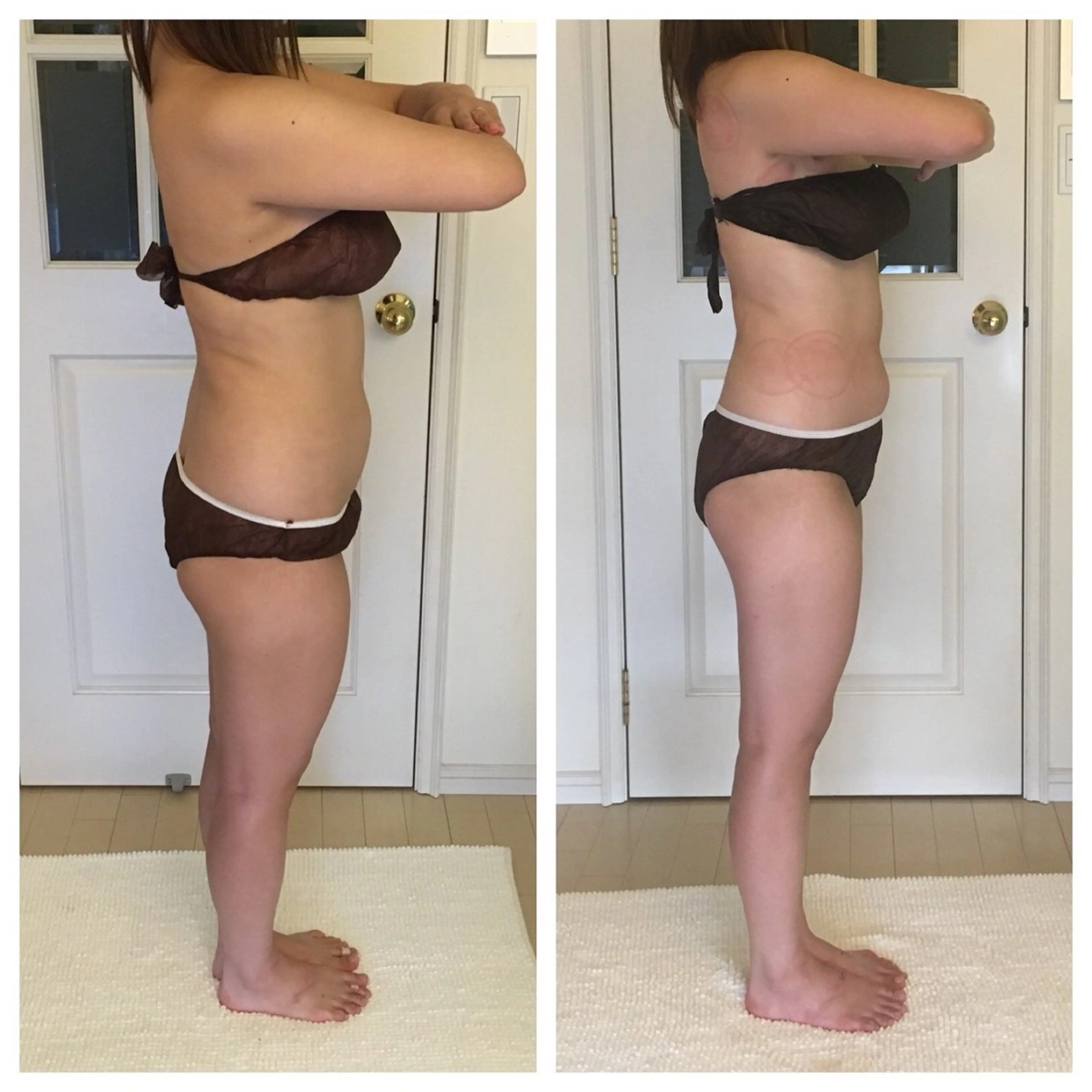 エステ リラク 吸い玉痩身専家所属・吸い玉 痩身専家FDLのエステ・リラクイメージ