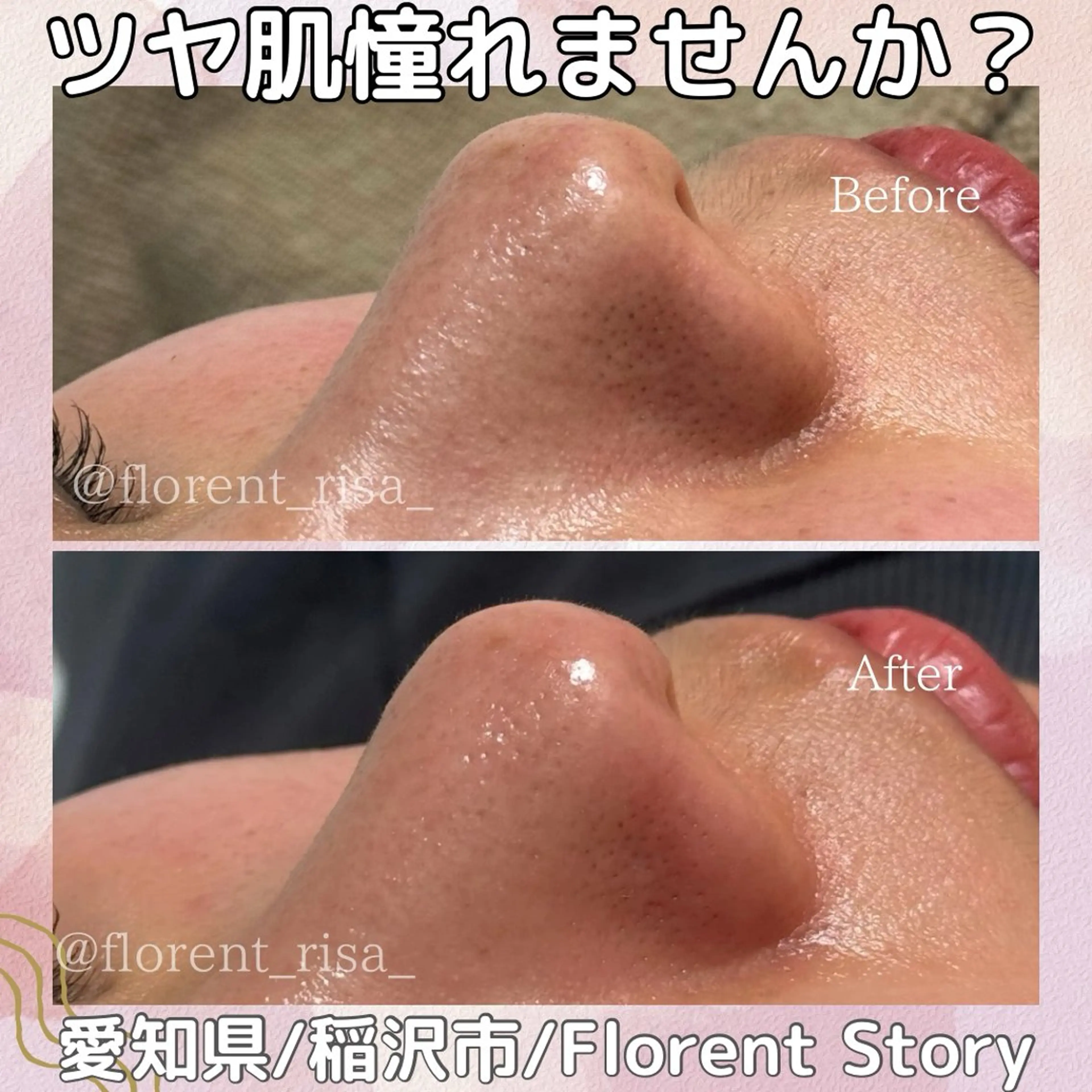 エステ 田中 里沙のエステ・リラクイメージ