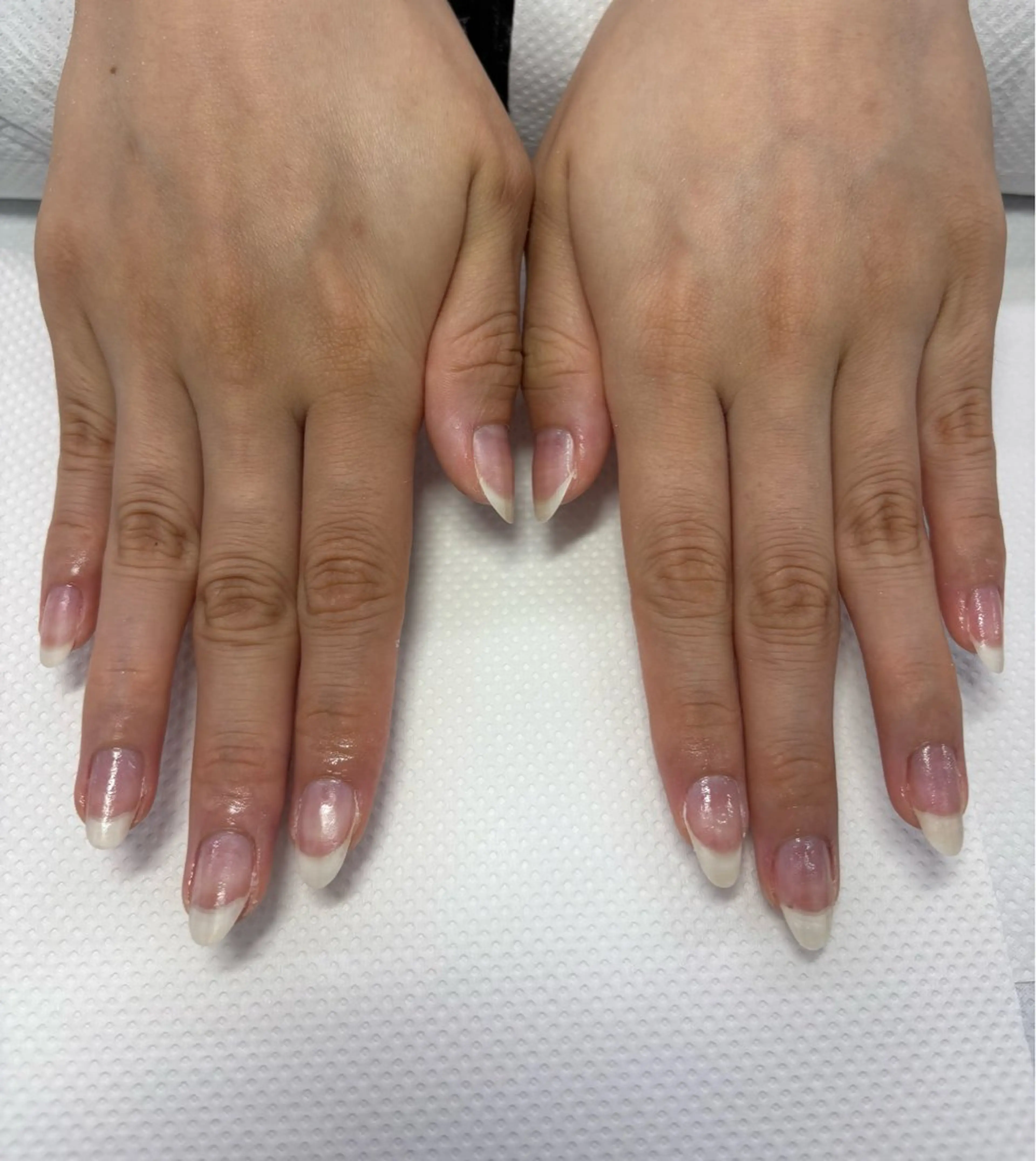 ネイル 楠本 琴音のネイルデザイン