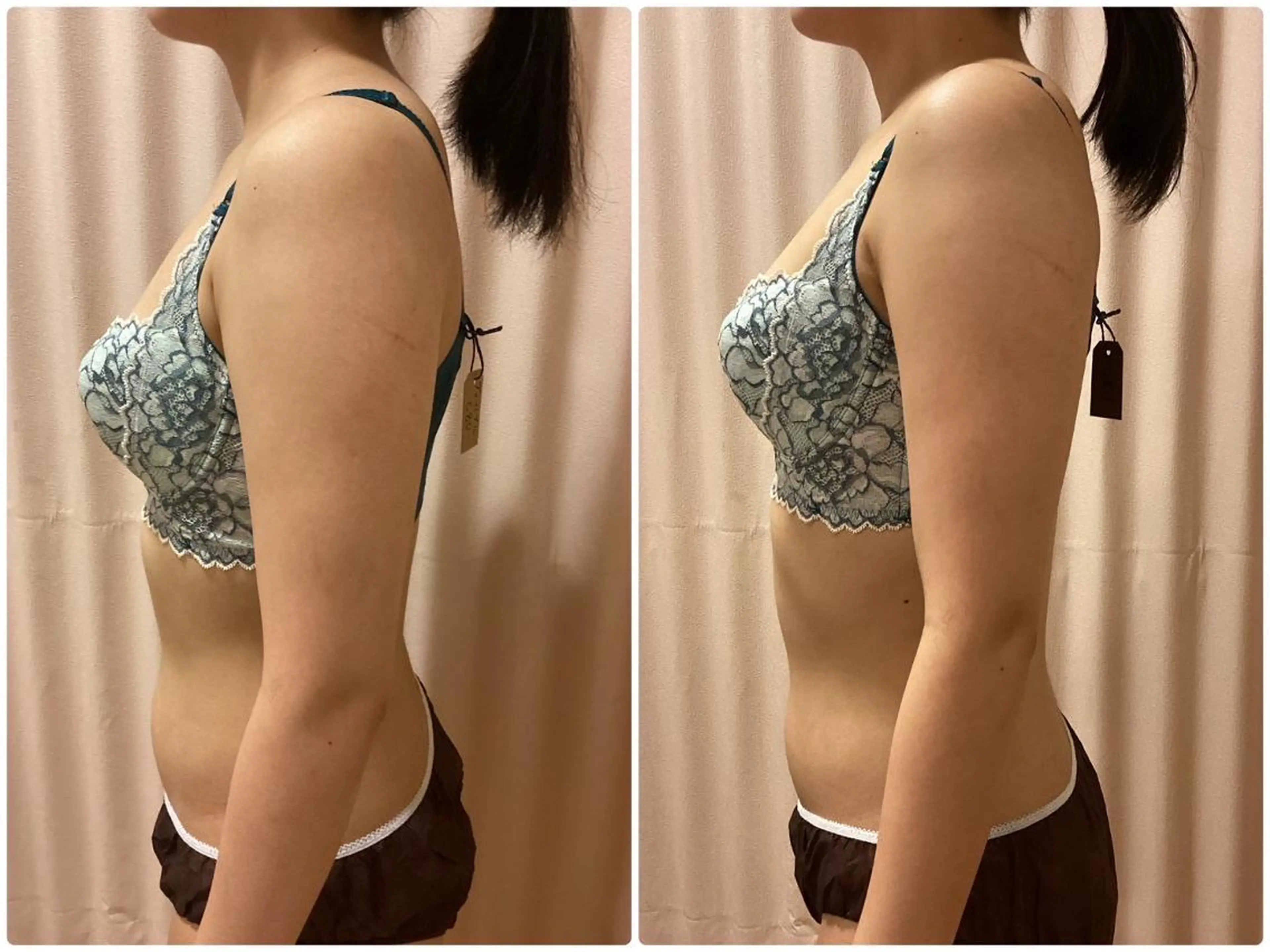 エステ リラク バスト＆フェイシャル RAYVISのエステ・リラクイメージ