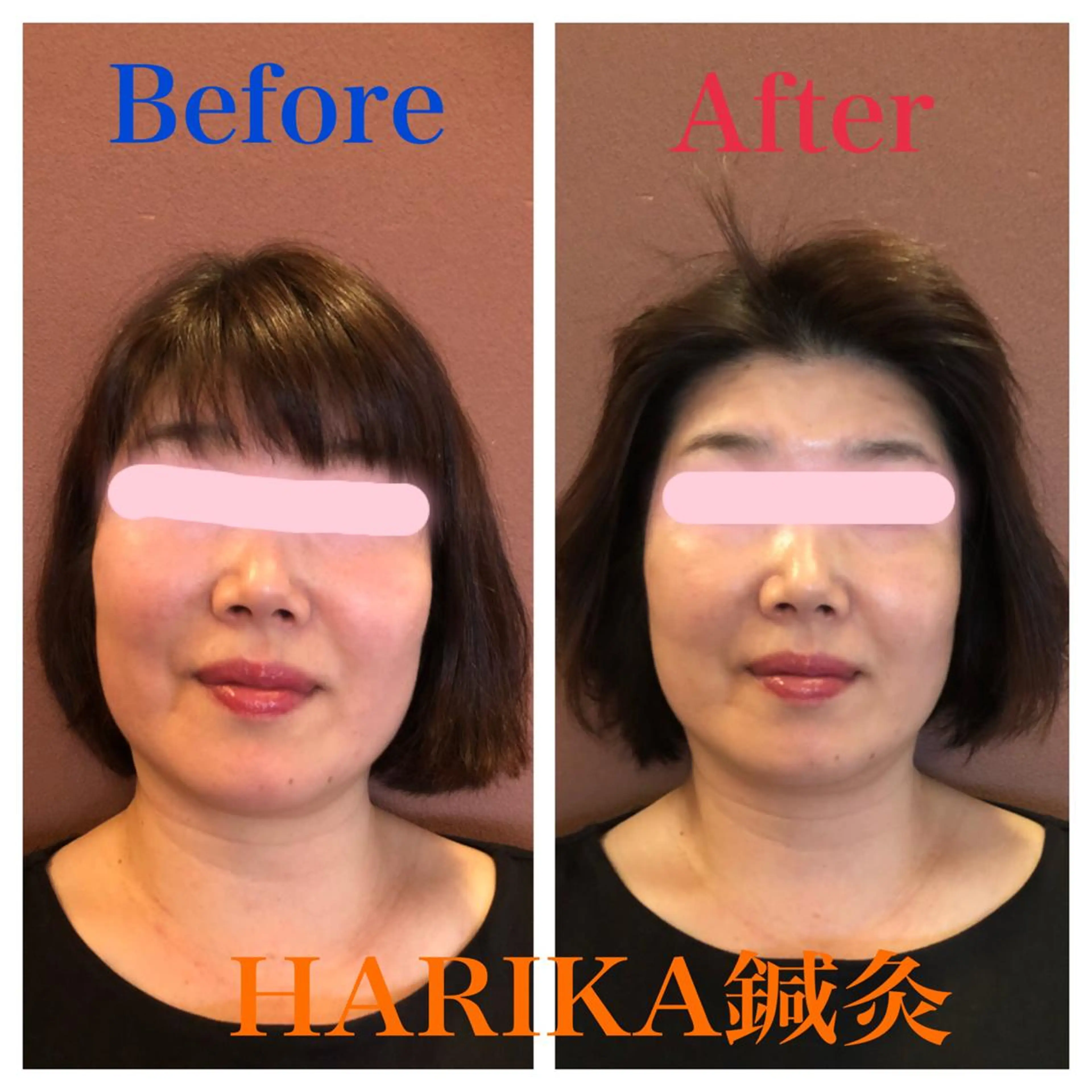 HARIKA鍼灸所属・HARIKA 鍼灸のその他イメージ