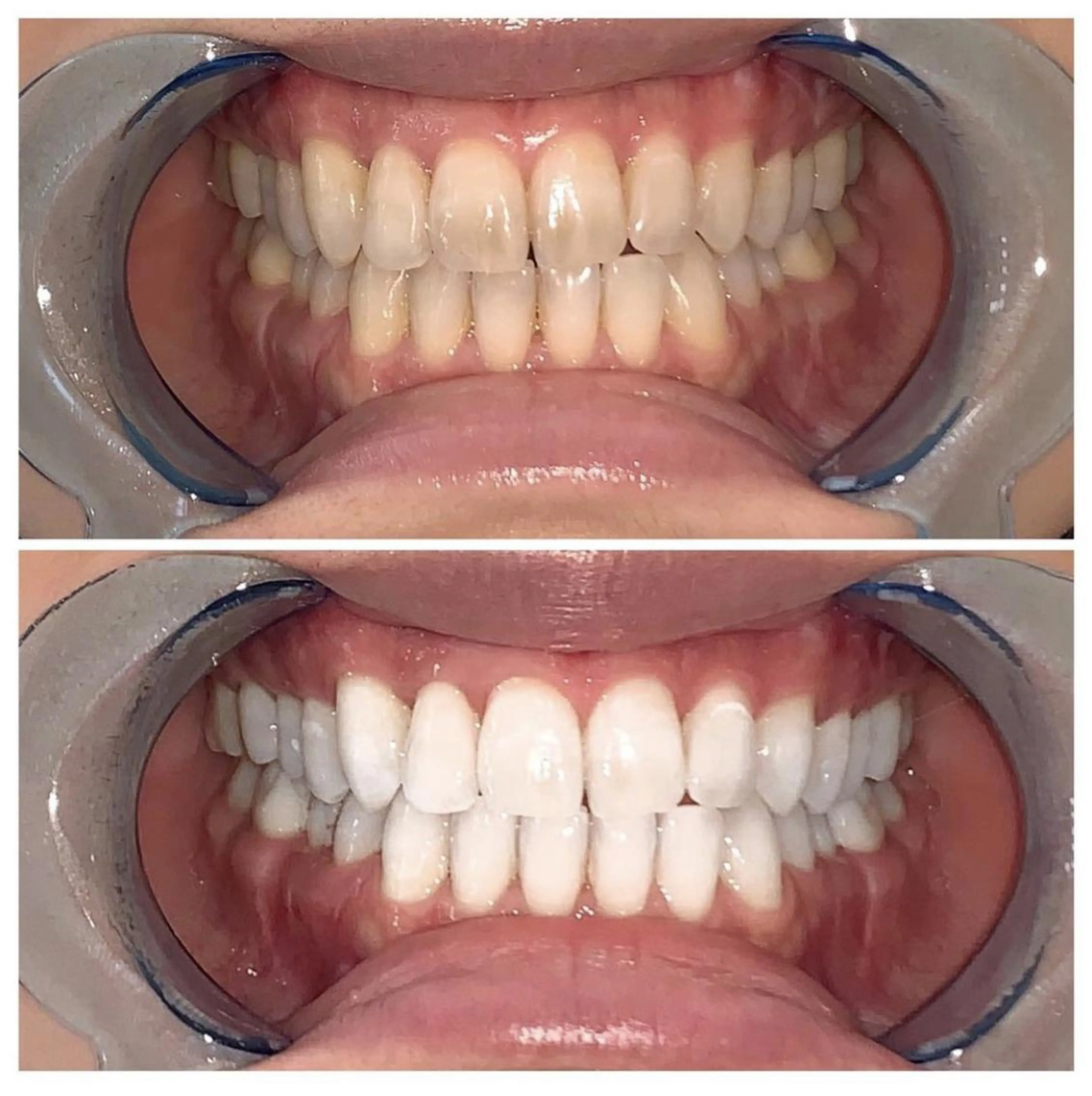 カラー メンズ マツエク・マツパ ネイル ヘアアレンジ パーマ キッズ アイブロウ ロング ホワイト その他 ライトビューティー 銀座本店のエステ・リラクイメージ