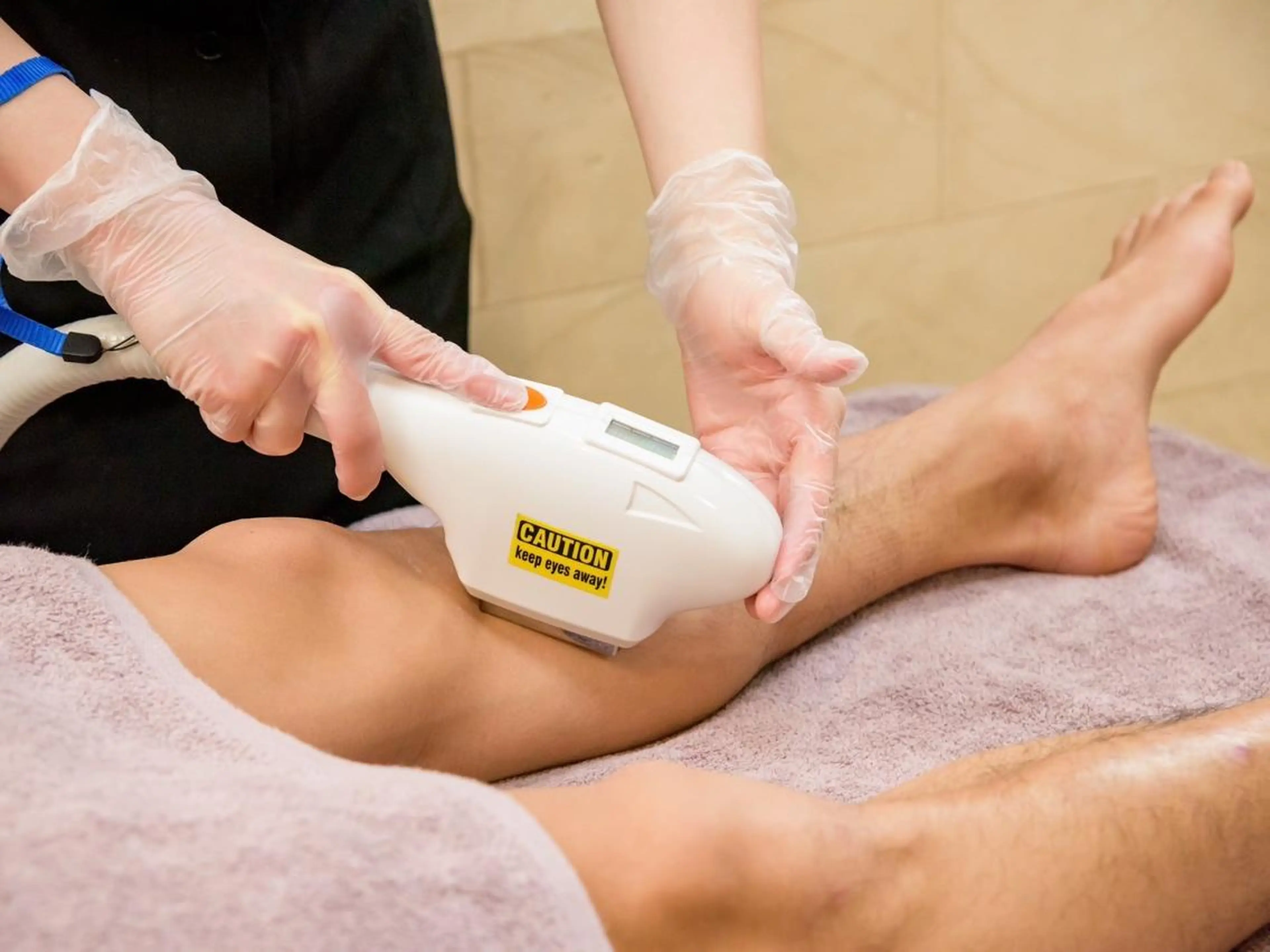 VIO(陰部)脱毛体験の写真