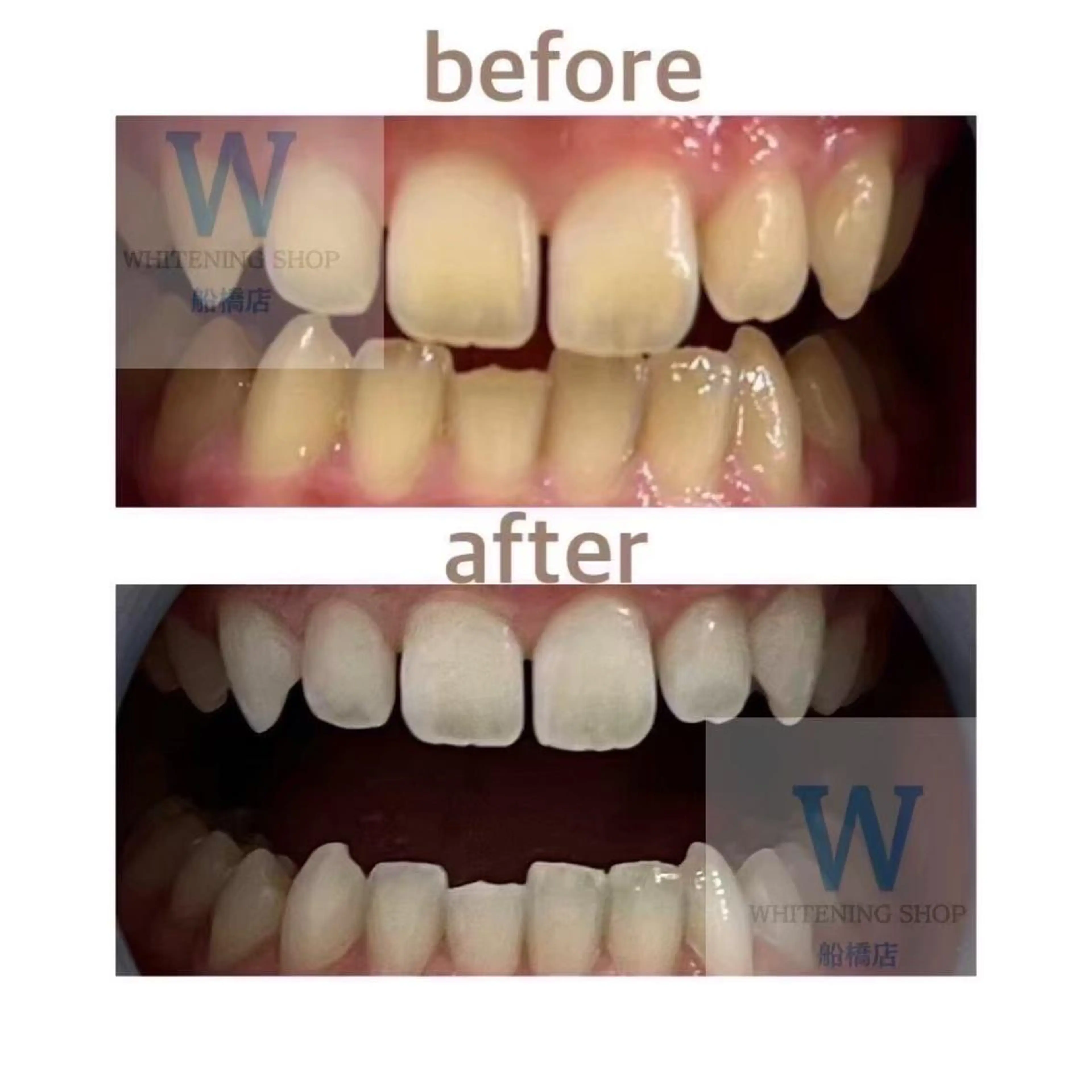 エステ リラク ホワイトニング ショップ船橋店🦷のエステ・リラクイメージ