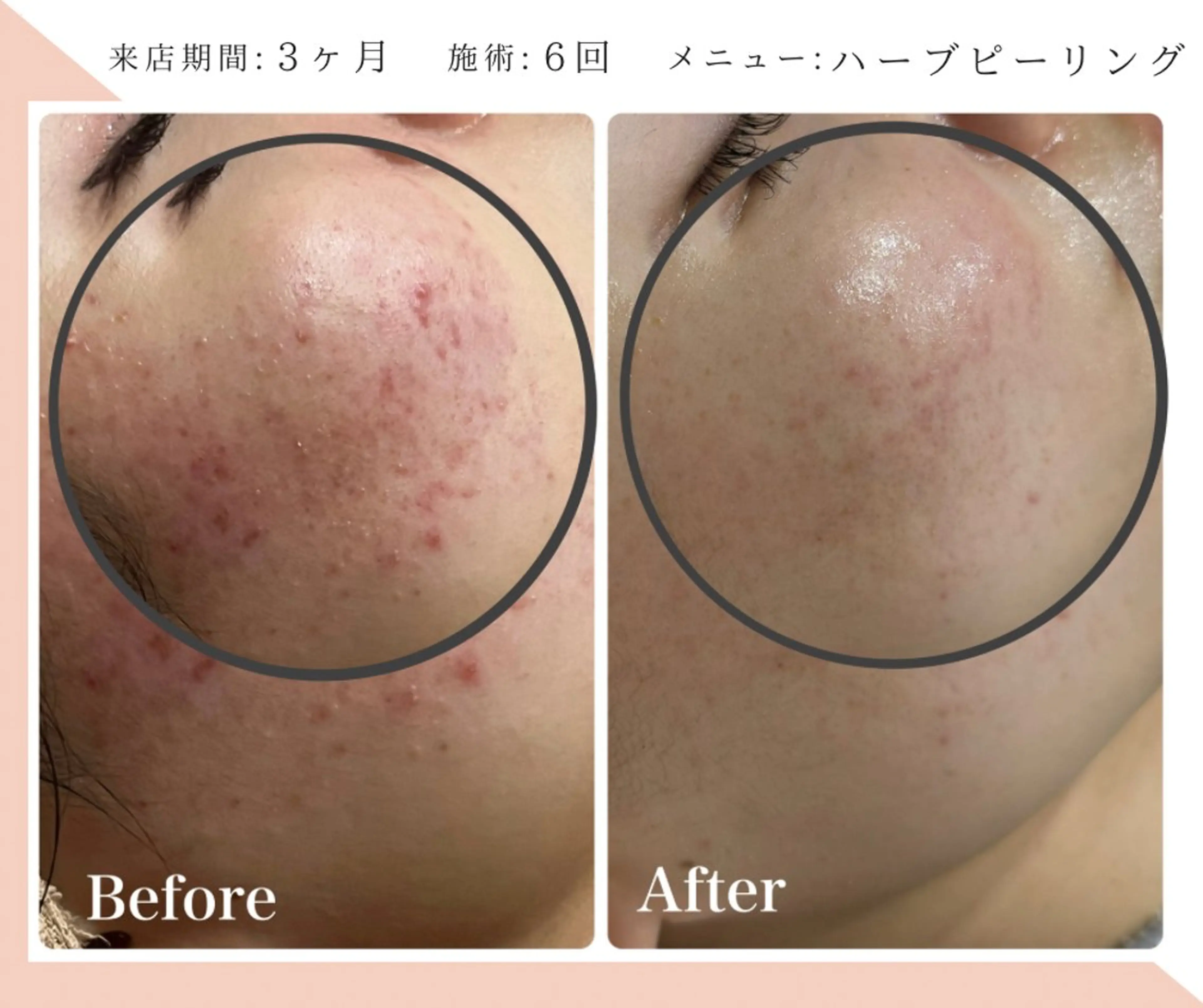 脱毛&フェイシャル 専門店muro.のエステ・リラクイメージ