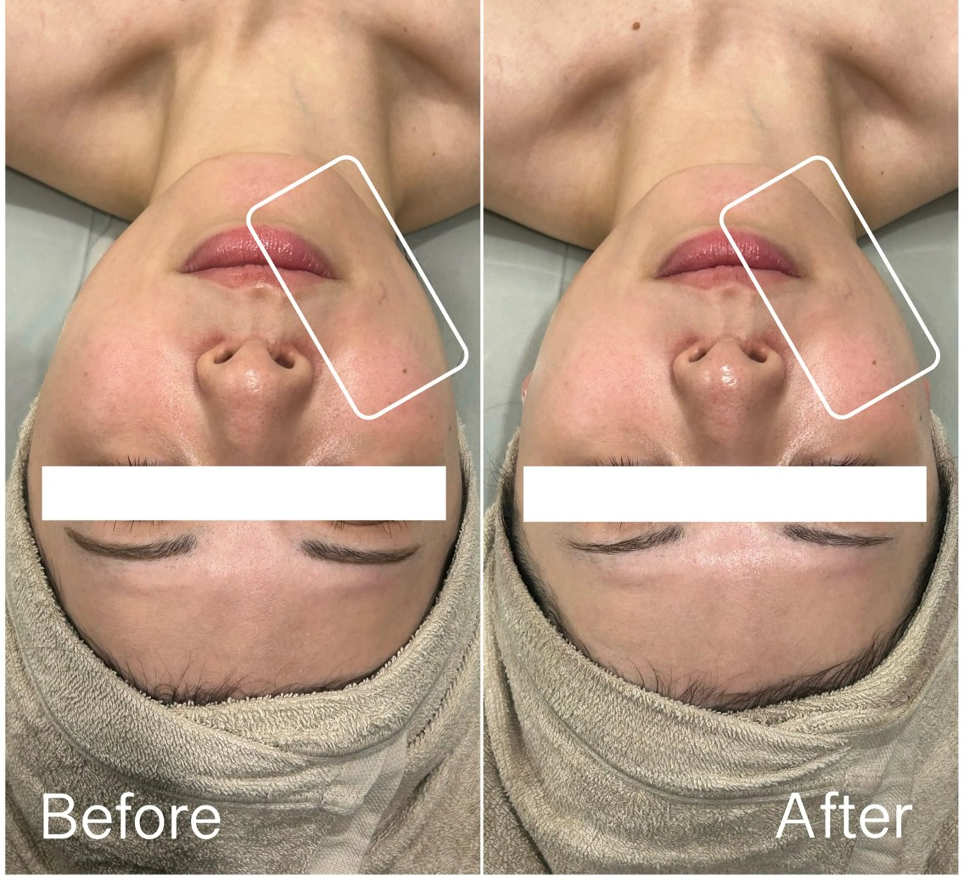 エステ 垣田 ジョアアンジェ京橋のエステ・リラクイメージ