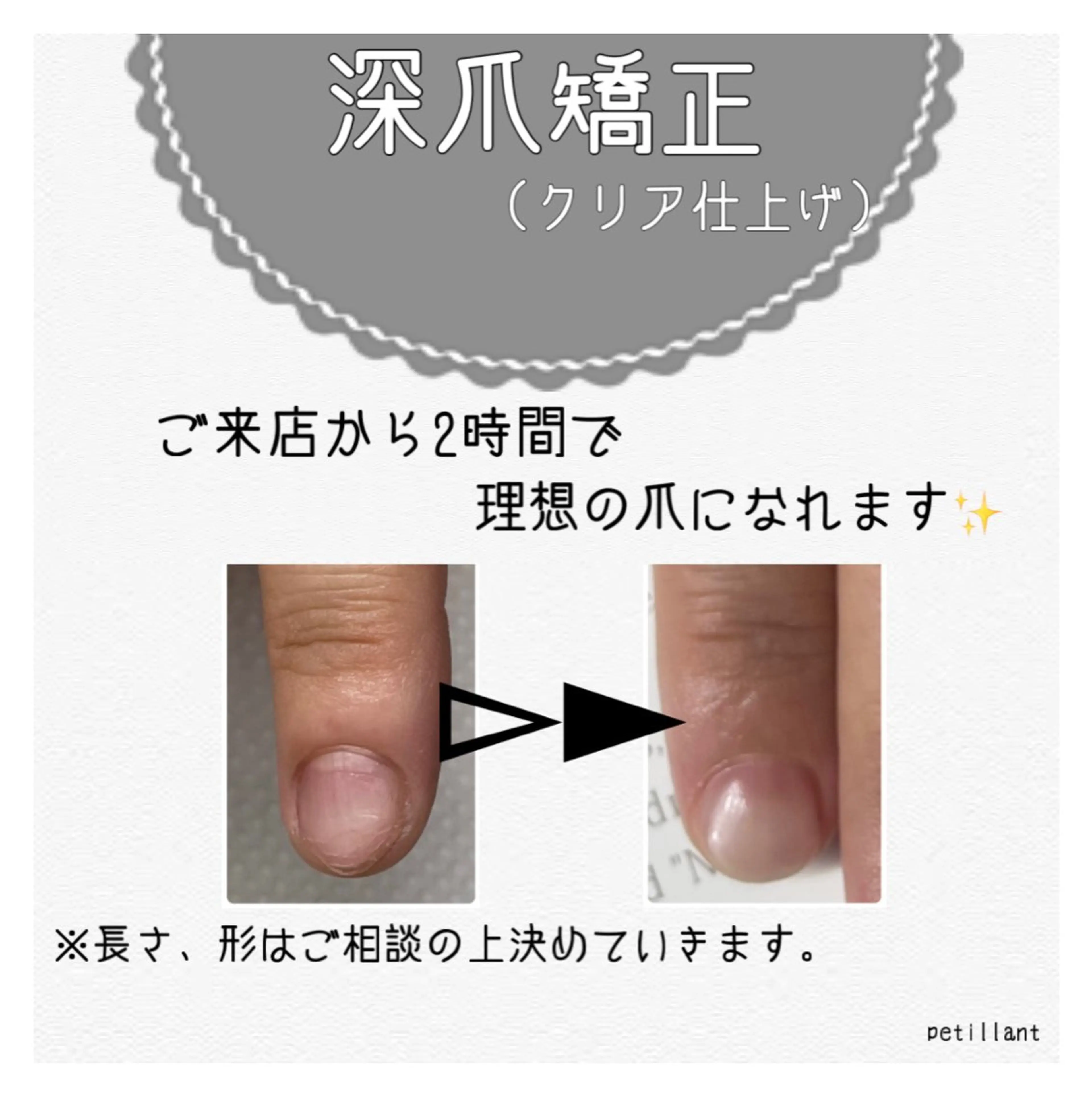 ネイル クリアネイル 長さ出し ジェルネイル マットネイル ハンドネイル ハンドケア petillant所属・nail salon petillantのネイルデザイン
