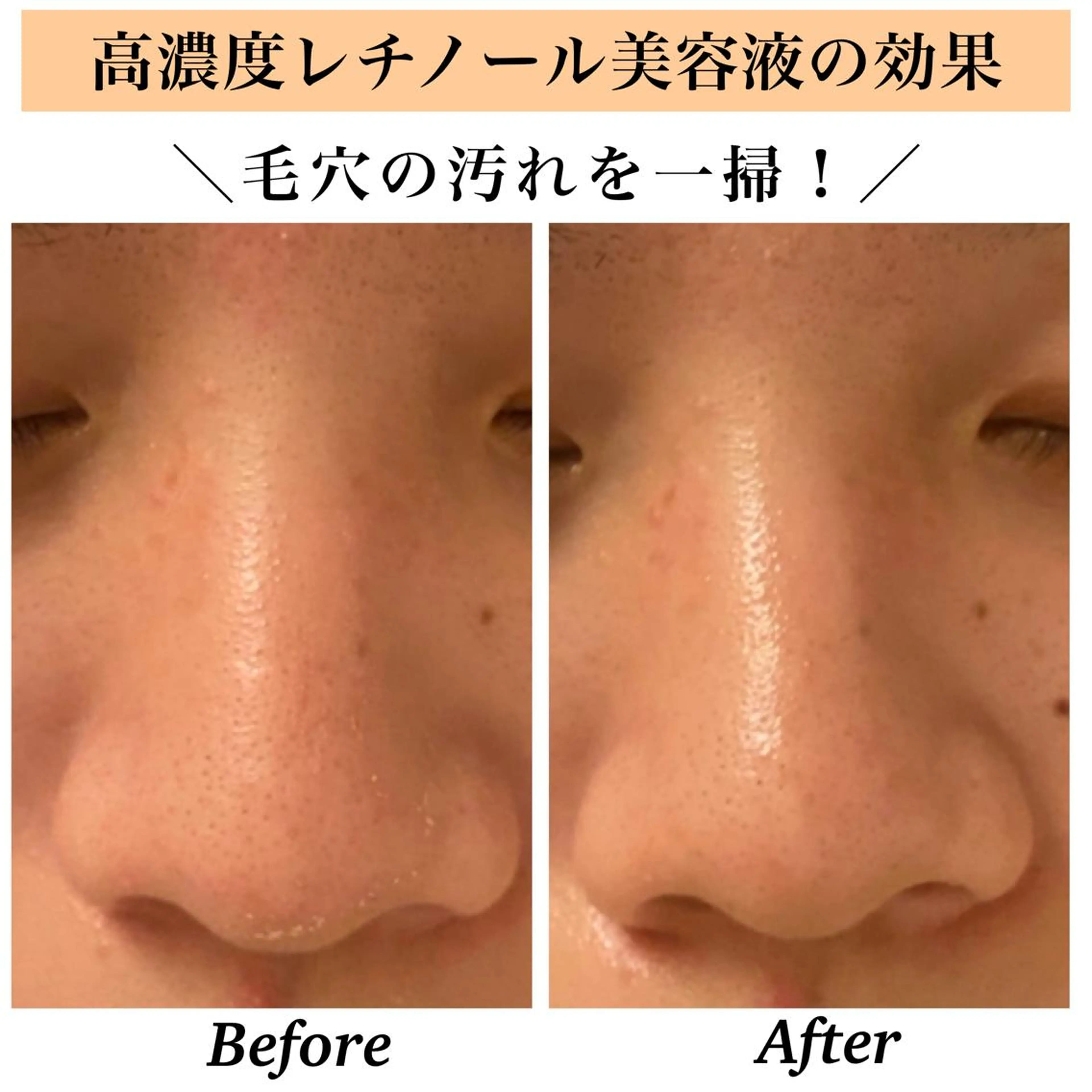 エステ リラク Bellesthe (ベルエステ)のエステ・リラクイメージ