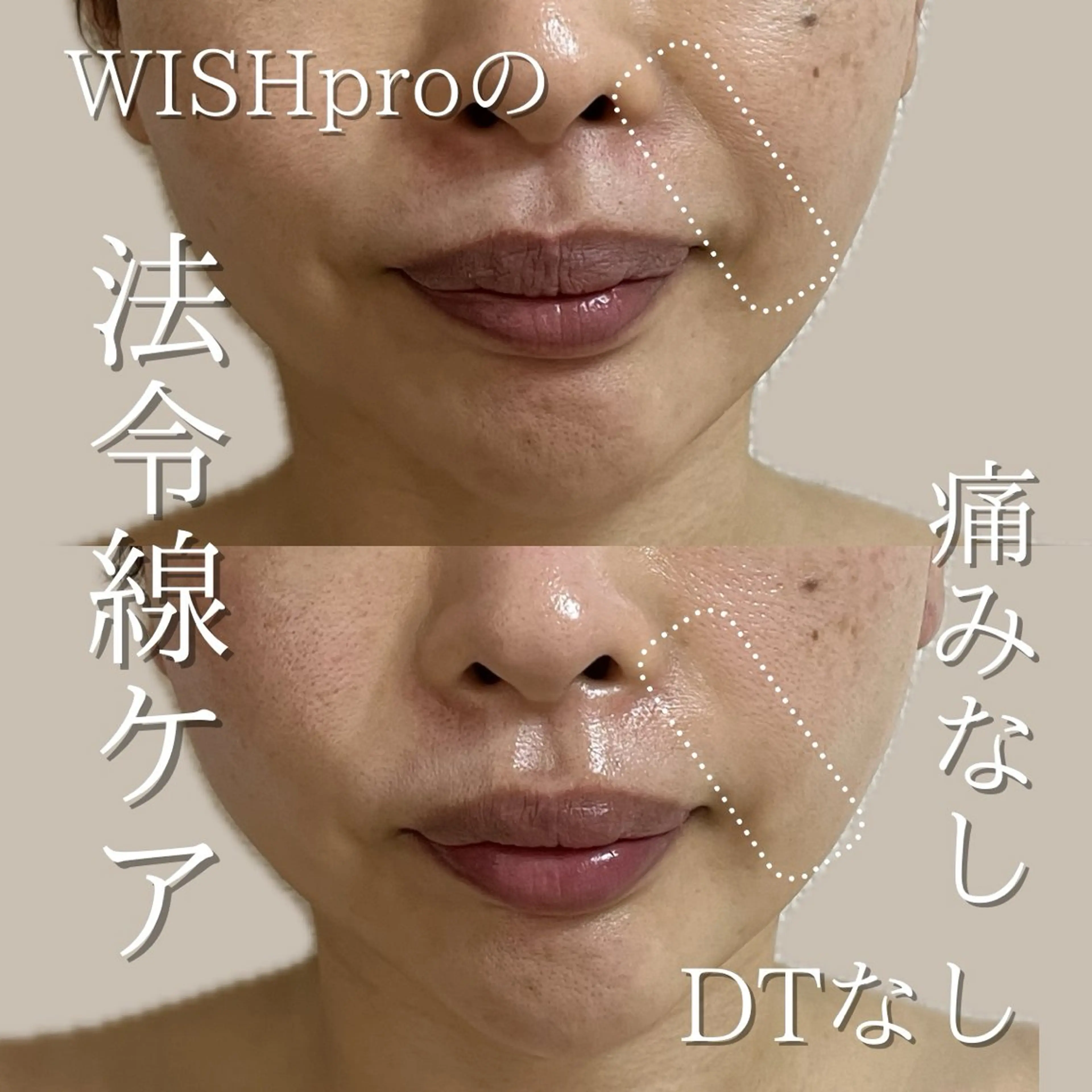 エステ リラク Total Beauty salon Bloom所属・肌質改善/ 脱毛/Bloomのエステ・リラクイメージ