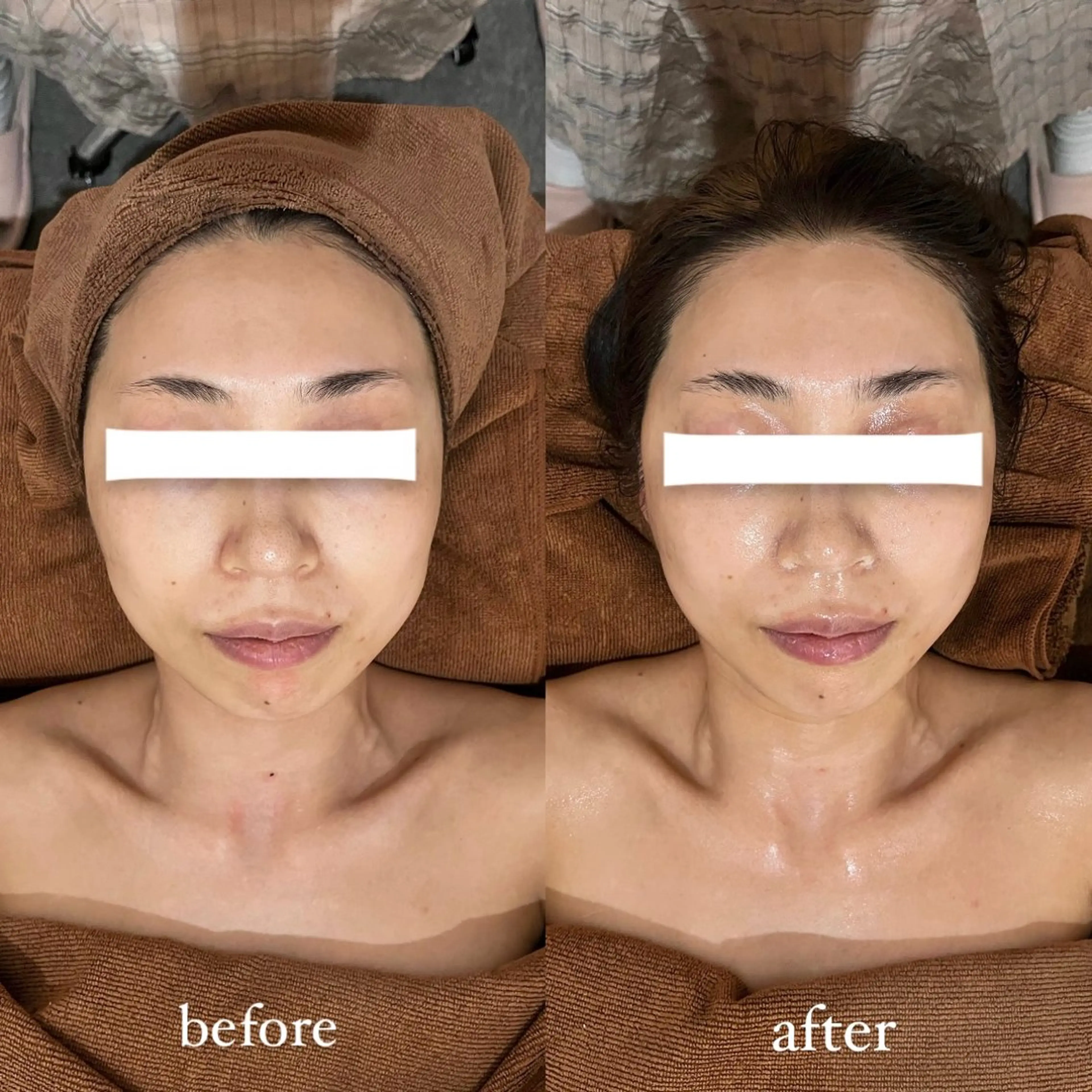 NOEL所属・フェイシャルエステ Utaiのエステ・リラクイメージ