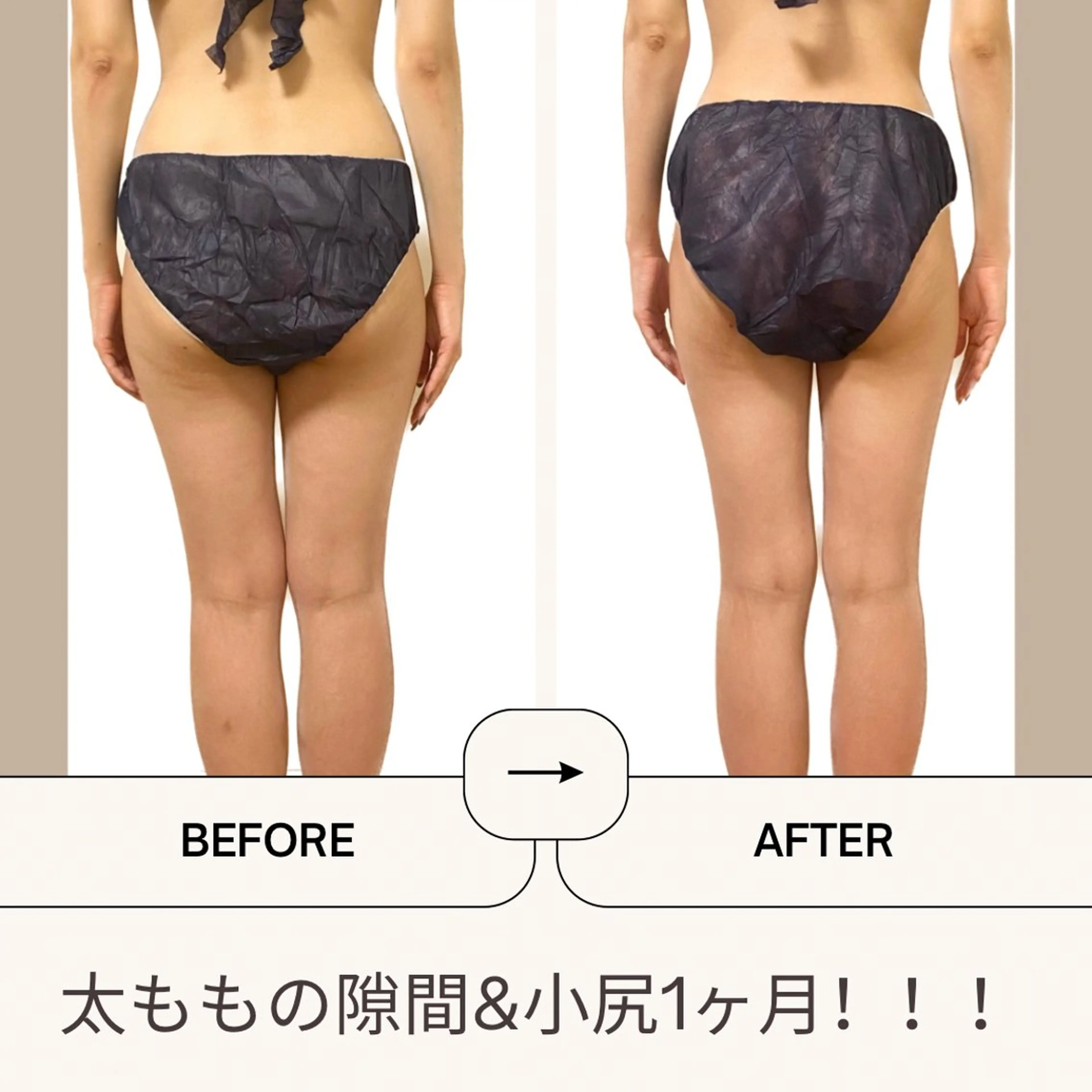 エステ Welina  Pono beauty salon所属・加藤 美有のエステ・リラクイメージ