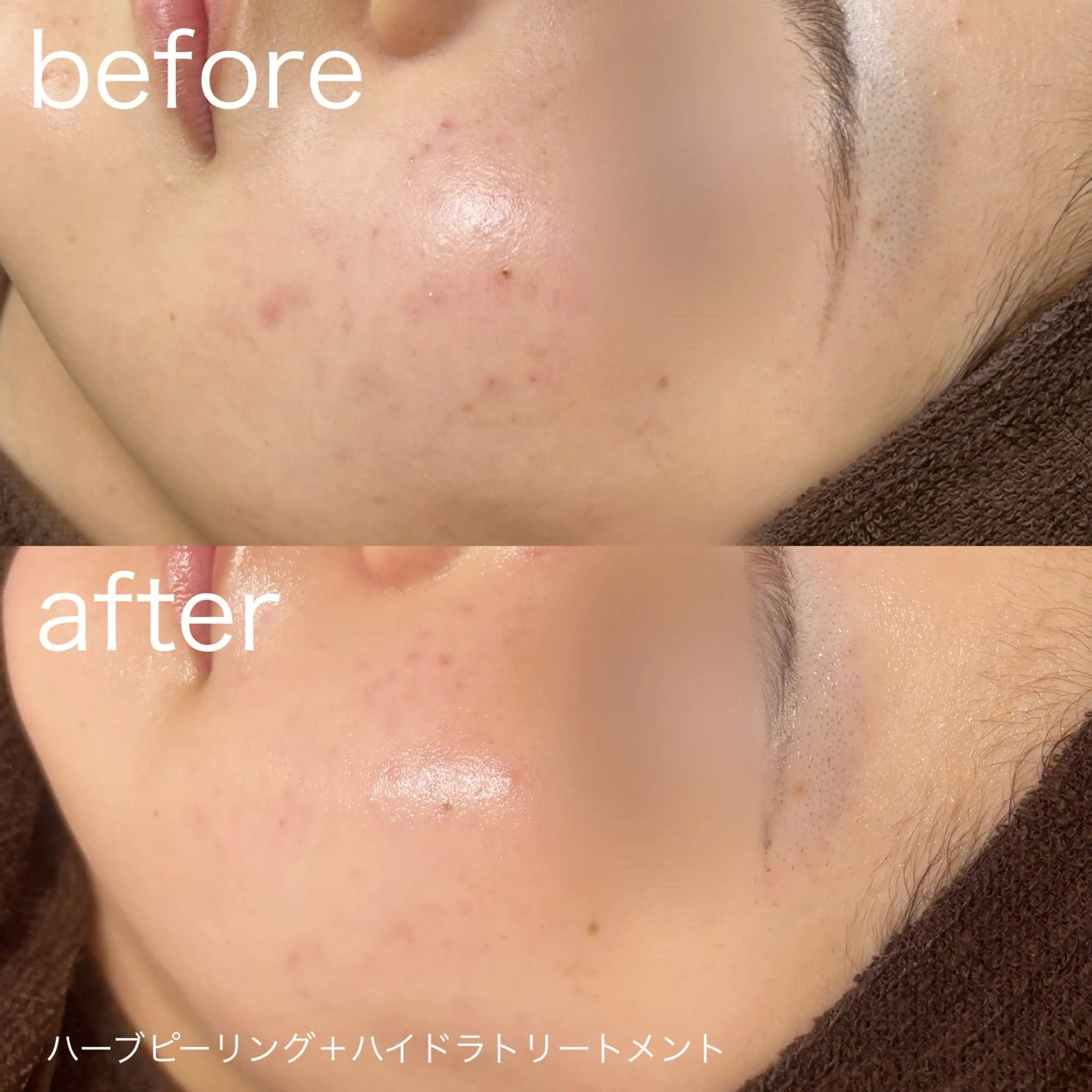 脱毛 lulula ricoのエステ・リラクイメージ