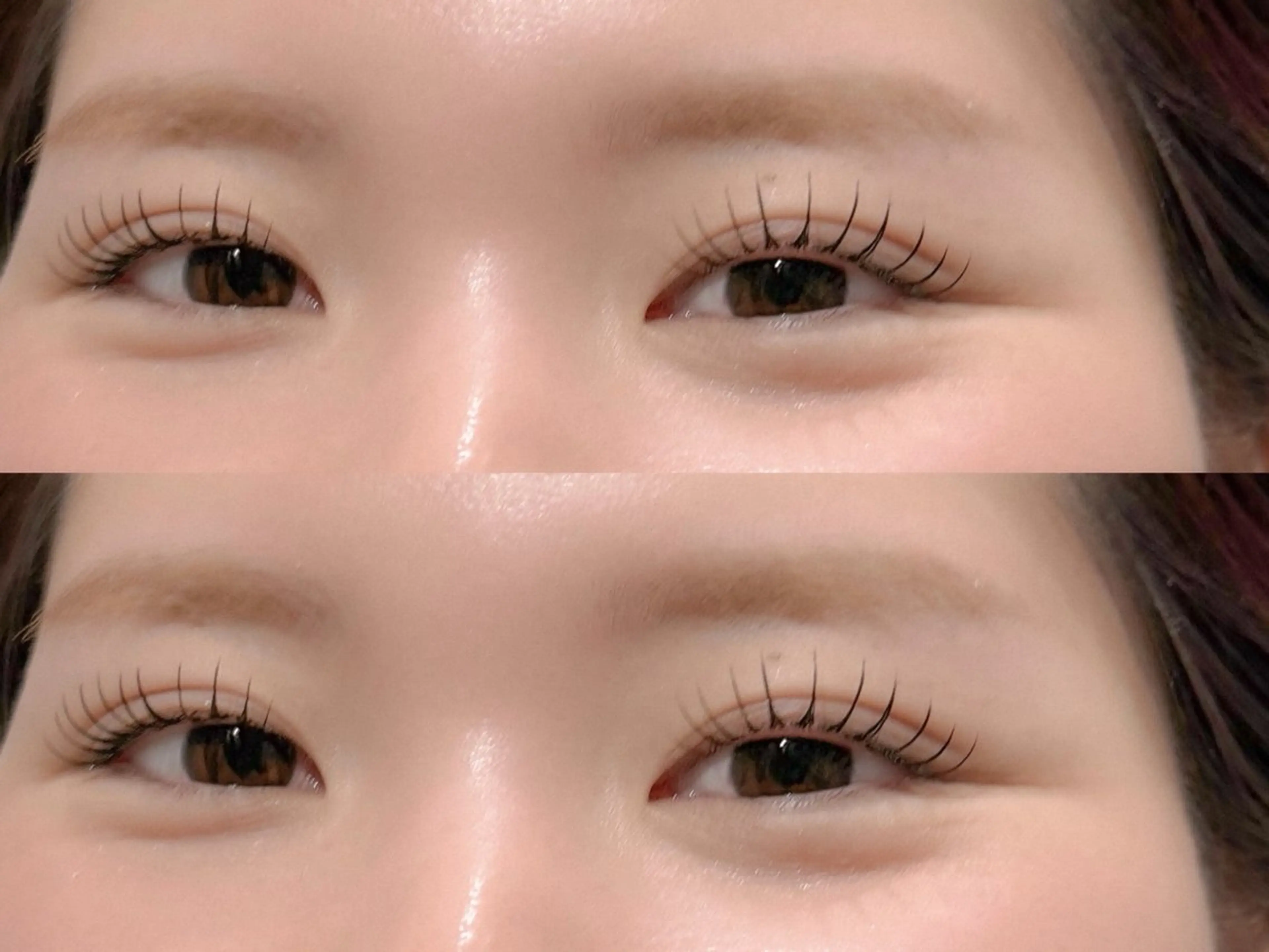 フラットラッシュ 100本の写真