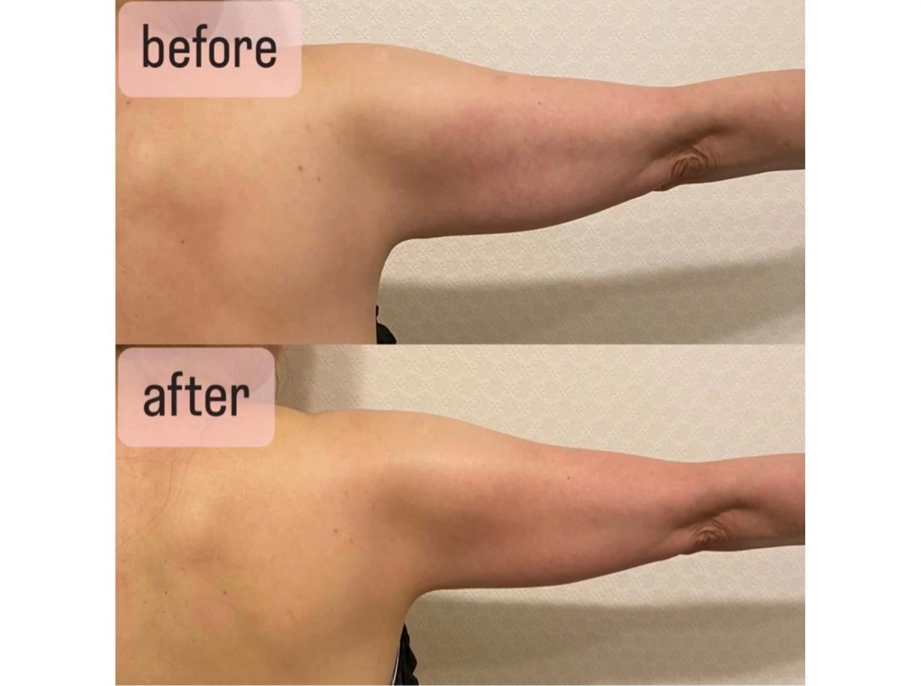 西区九条エステ MITUREIサロンのエステ・リラクイメージ