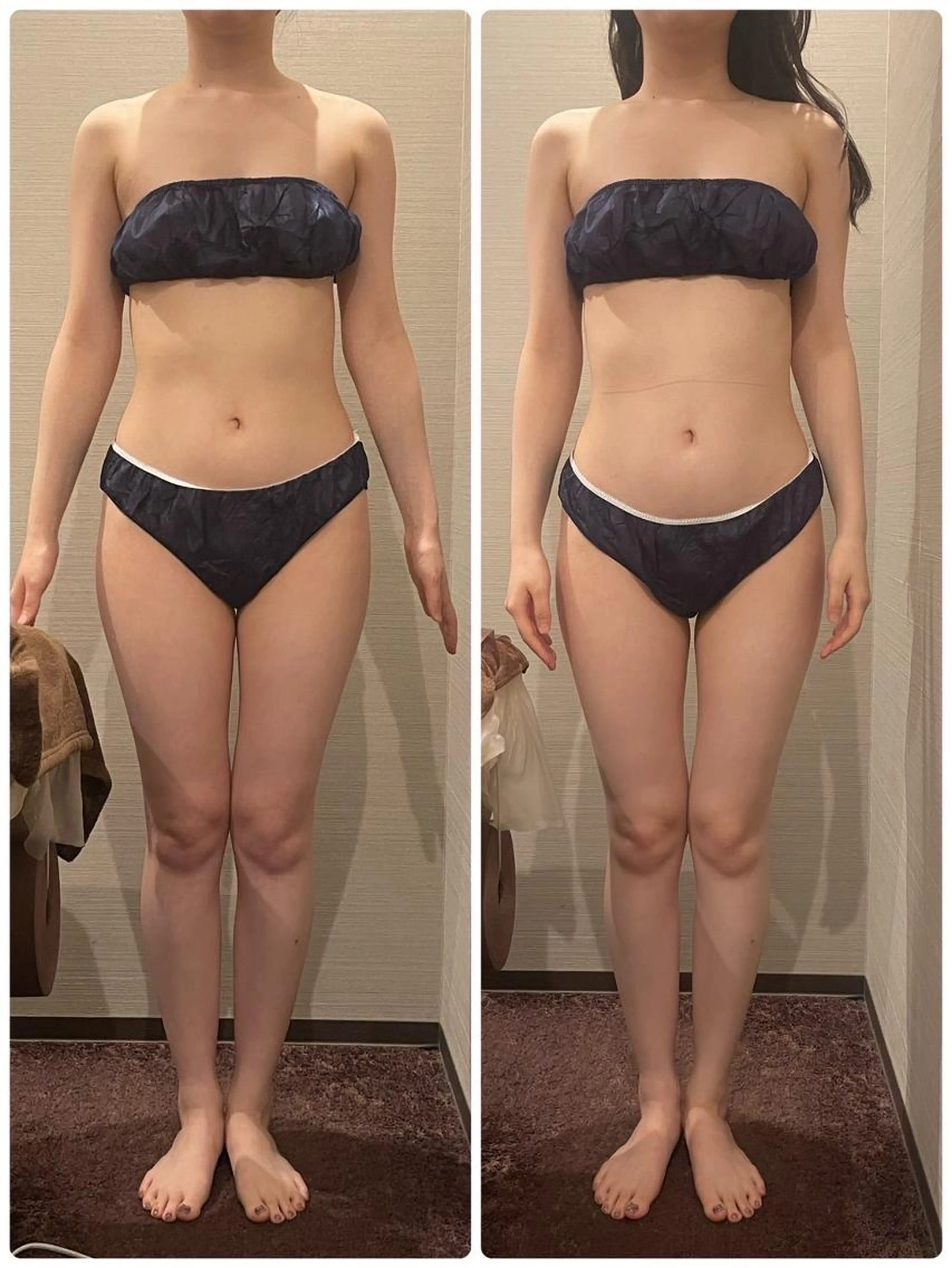 冬こそ集中ケア⭐️食欲に負けない美しいボディラインへ‼️の写真