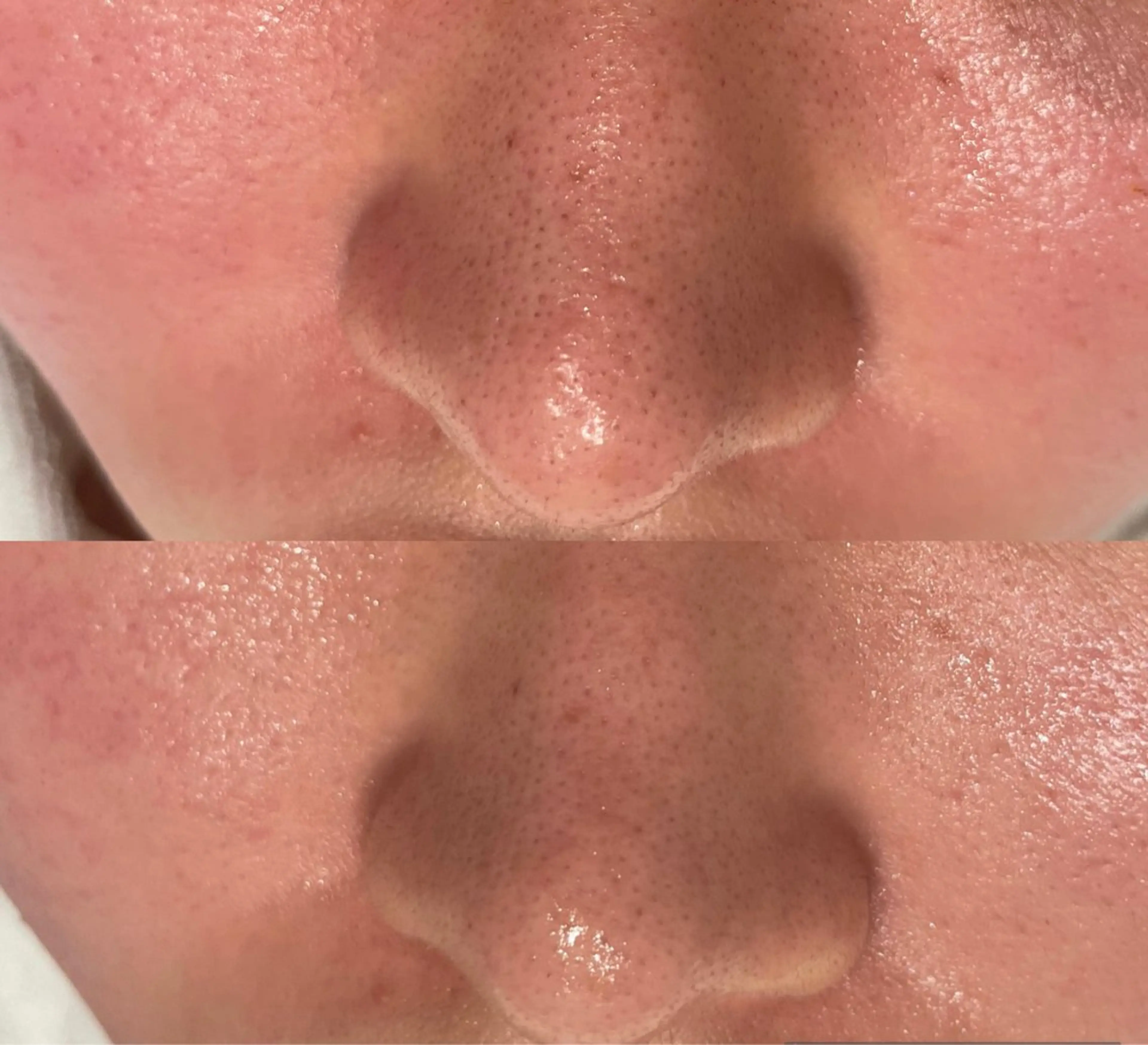 DeI'm   名古屋栄所属・小林 玲菜のエステ・リラクイメージ