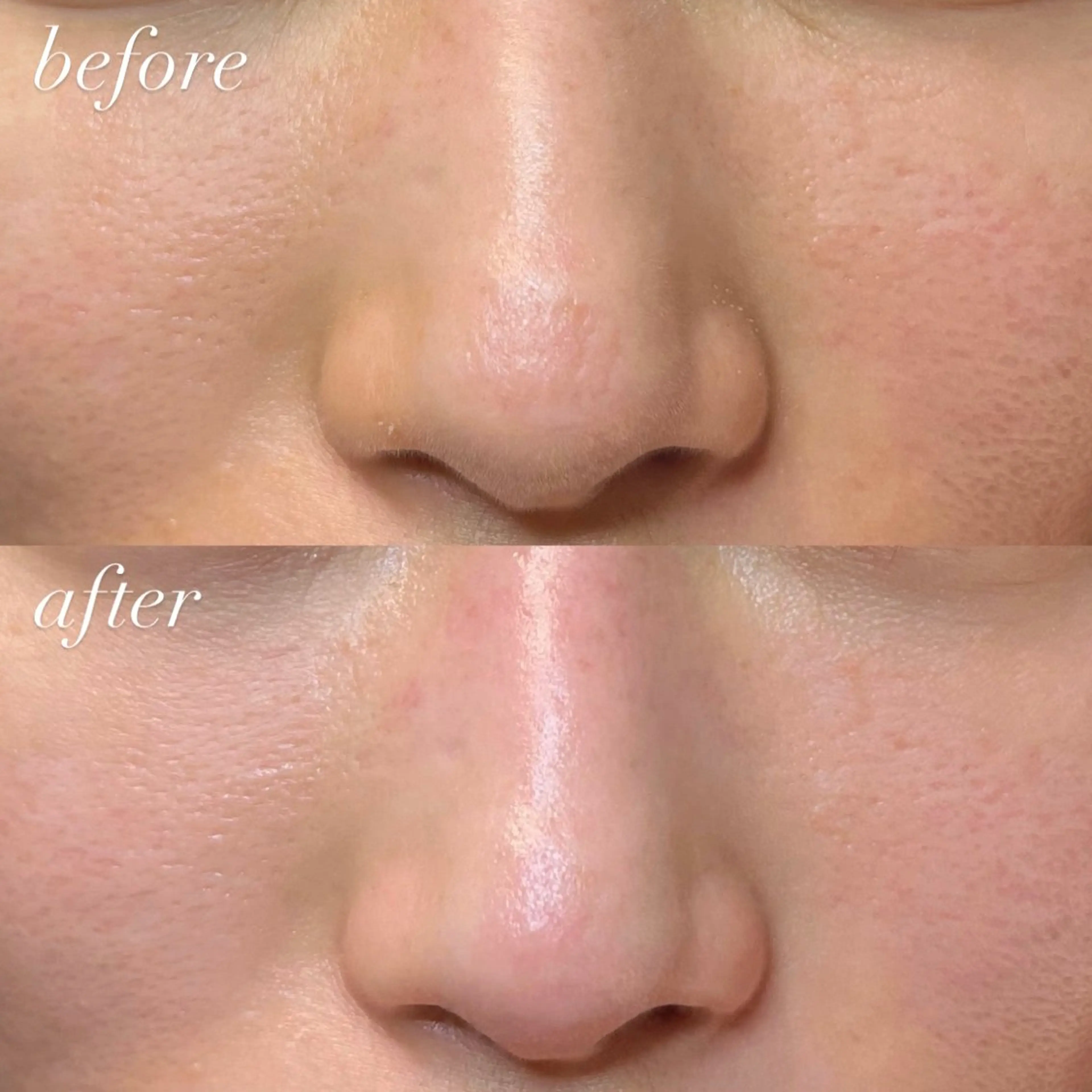 ワックス脱毛 眉カット seReno eyebrow&eyelash目黒本店所属・seReno KOHAKUの眉毛・アイブロウイメージ