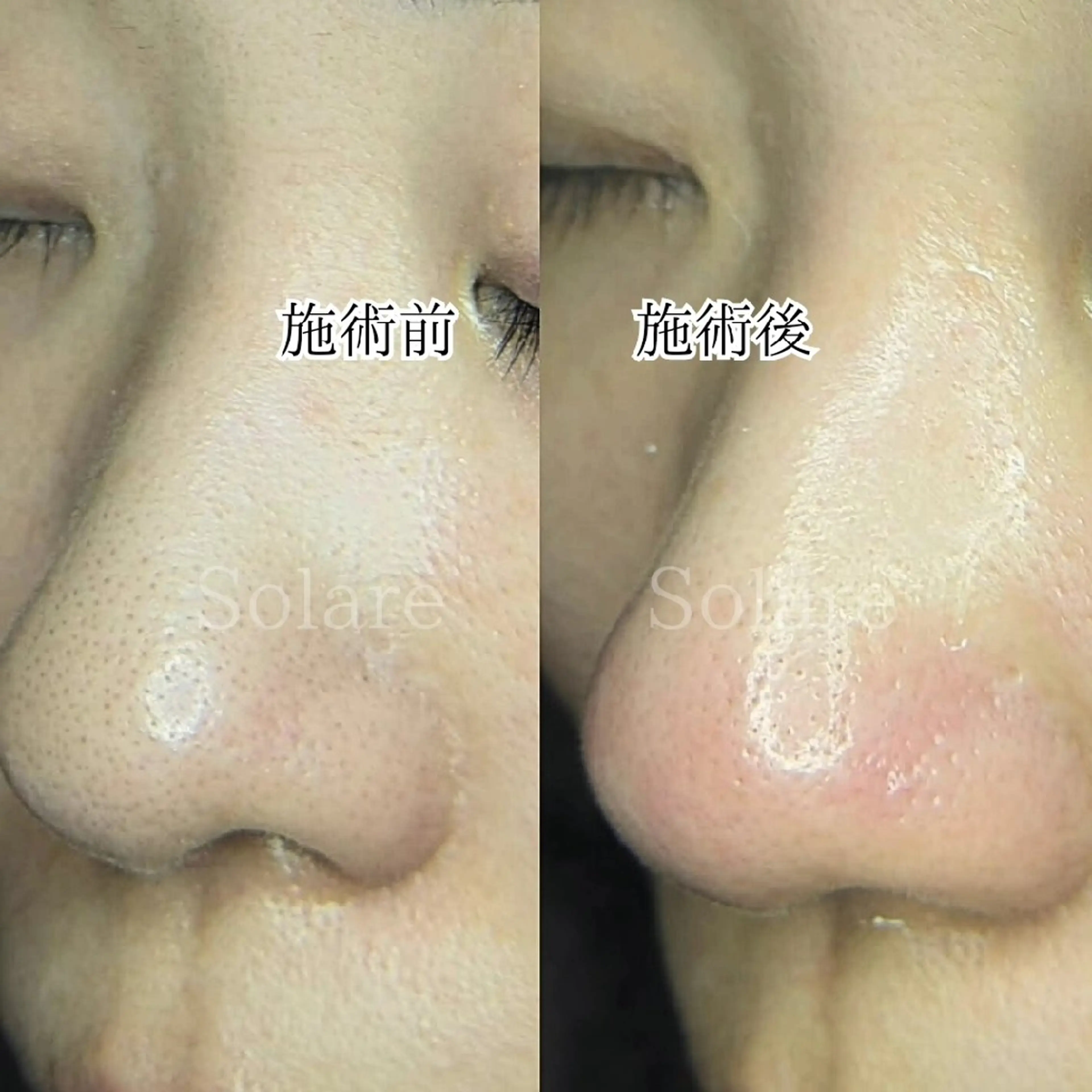  毛穴洗浄・まつ毛 の専門店 ソラーレのエステ・リラクイメージ